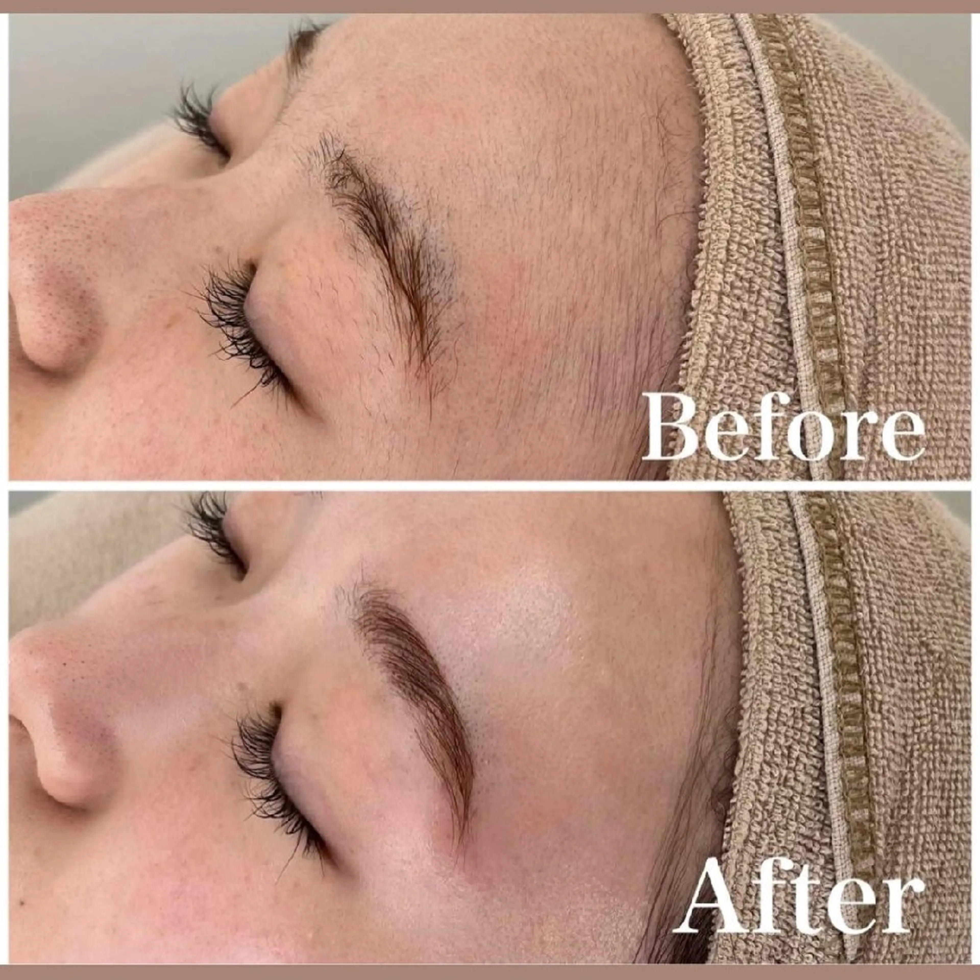 【移転記念】お顔シェービング+フェイシャル+リンパ✨究極のむきたまご肌コース♡の写真