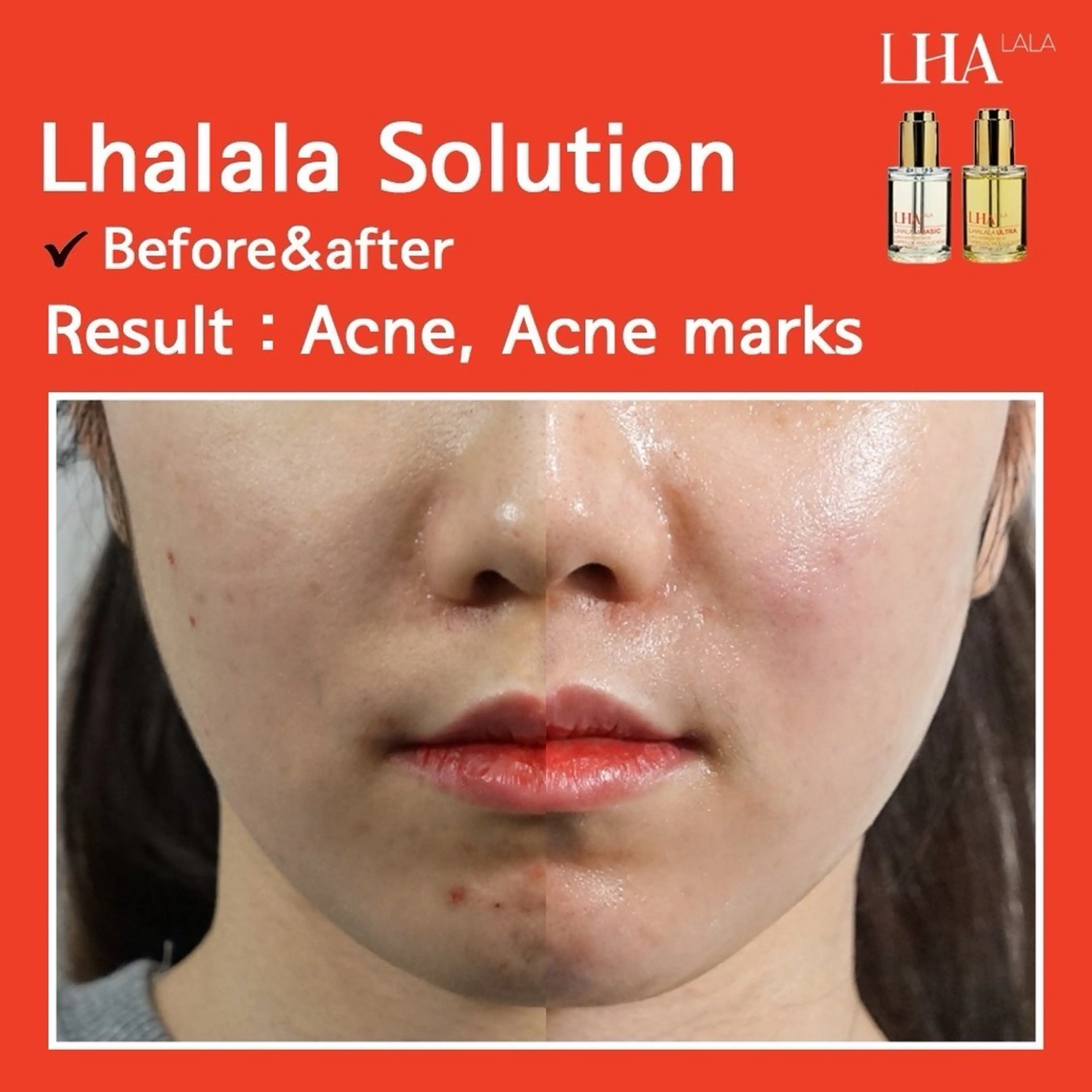 ララピール初めてのお客様❤︎の写真