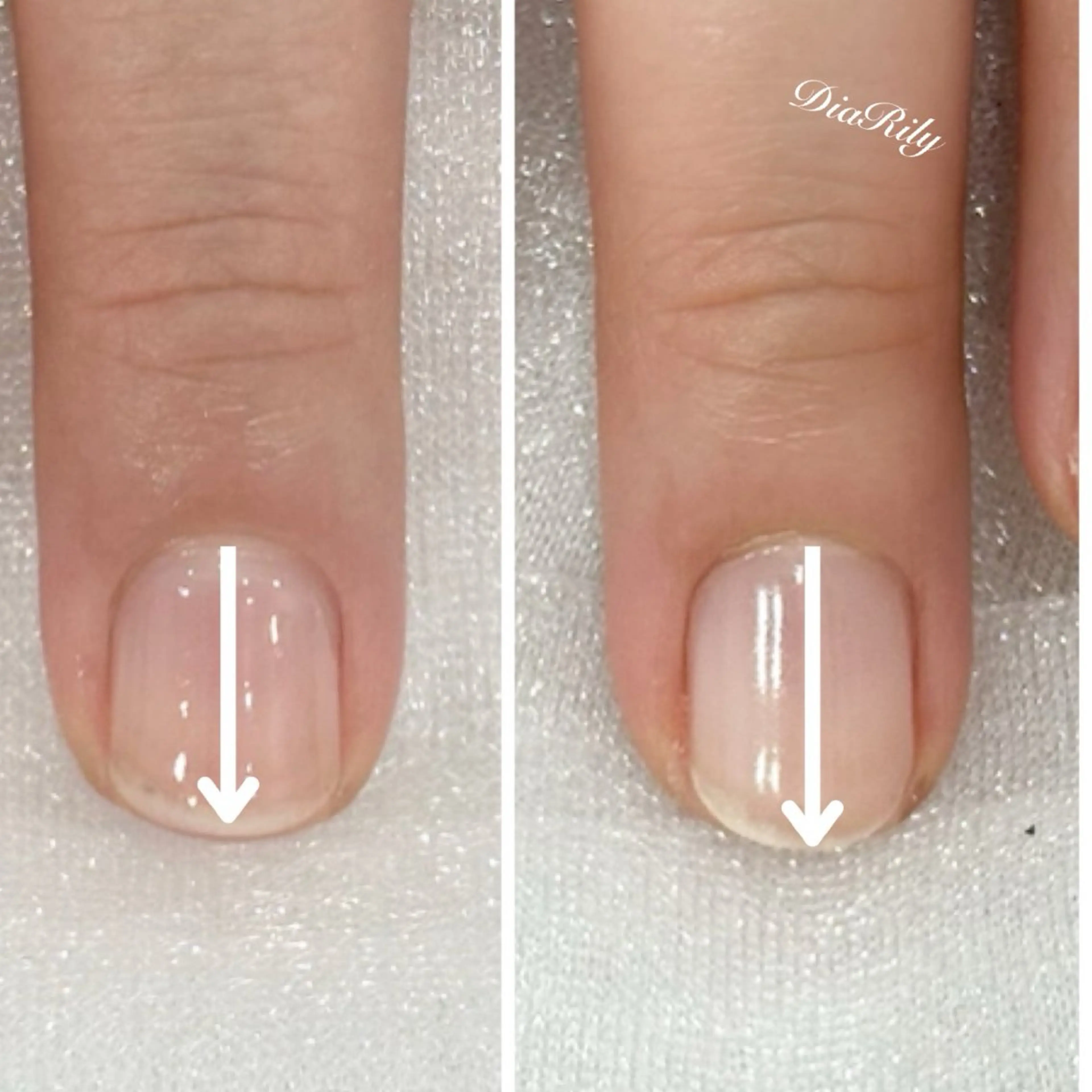 ネイル DiaRily所属・diarily はるひのネイルデザイン