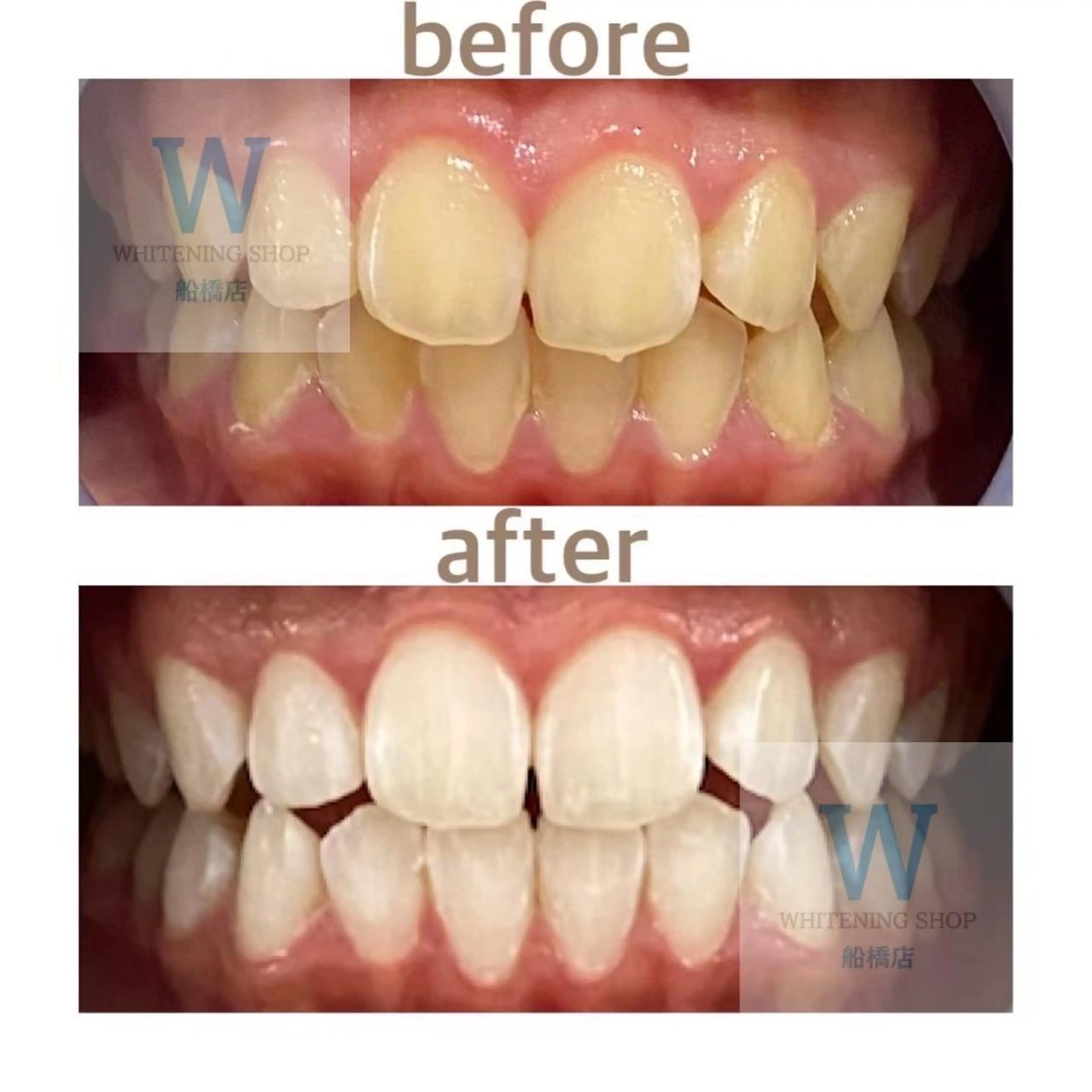 エステ リラク ホワイトニング ショップ船橋2号店のエステ・リラクイメージ