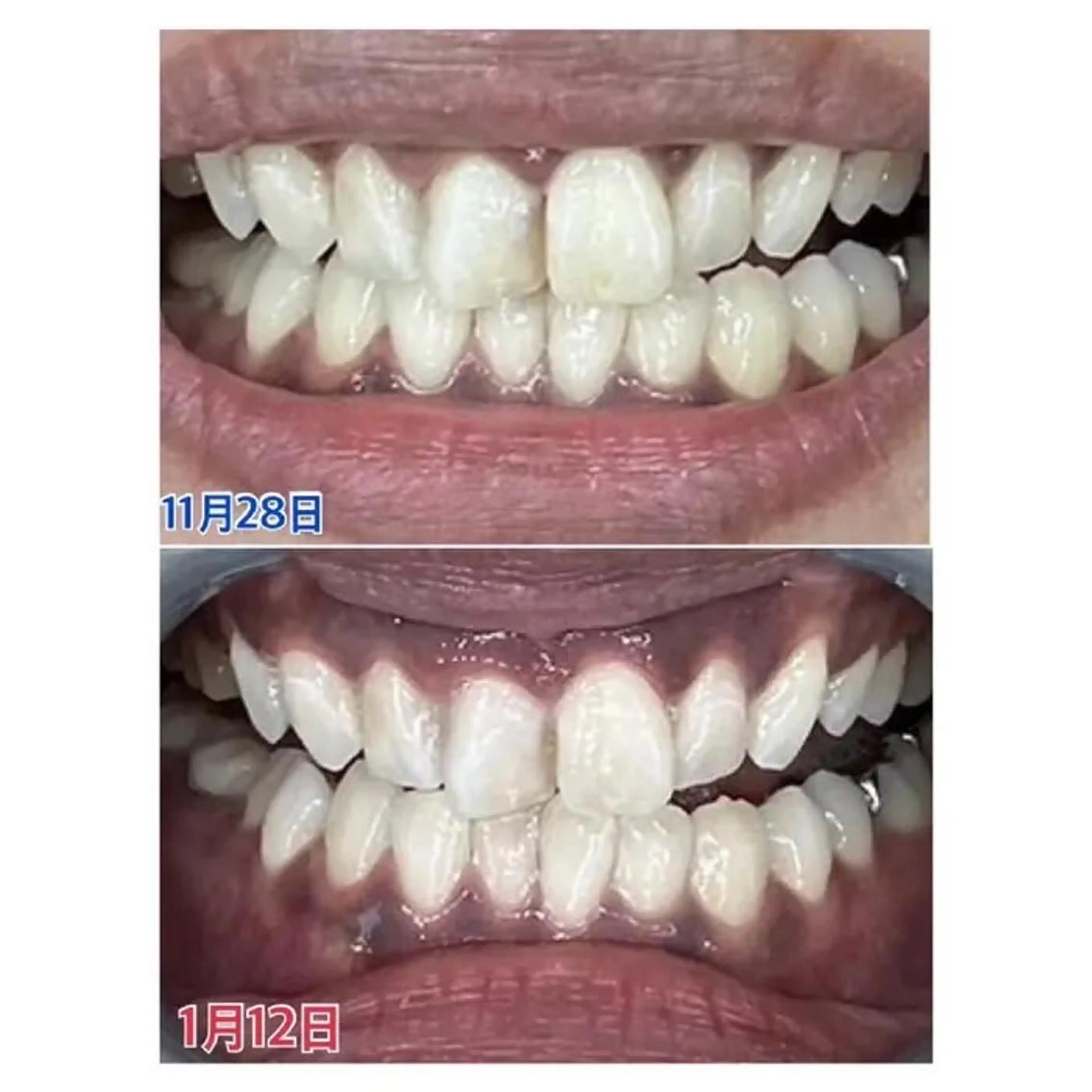 M渋谷店所属・Ｍ渋谷 ホワイトニングのエステ・リラクイメージ