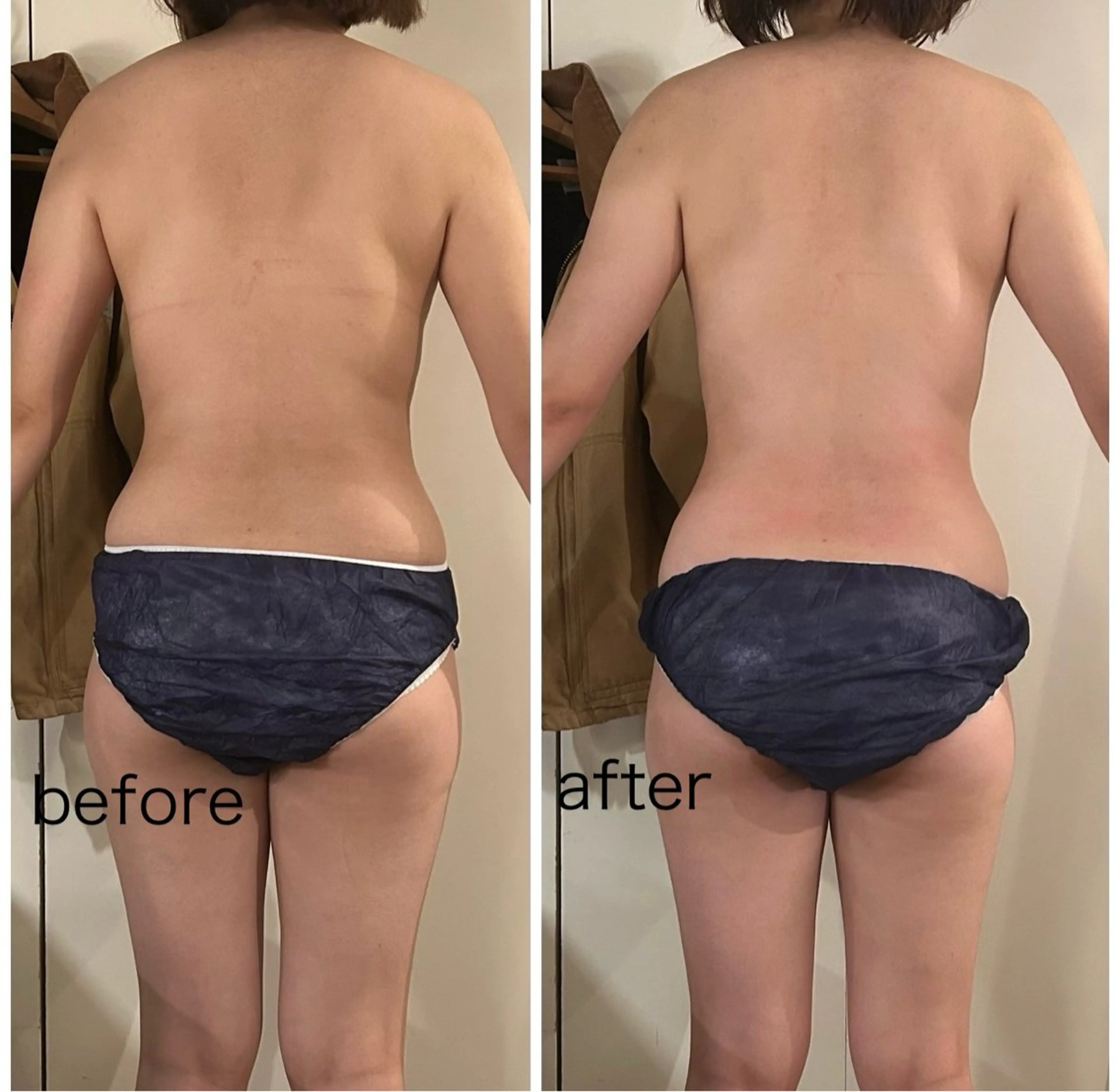 エステ リラク プライベートサロン シュシュのエステ・リラクイメージ