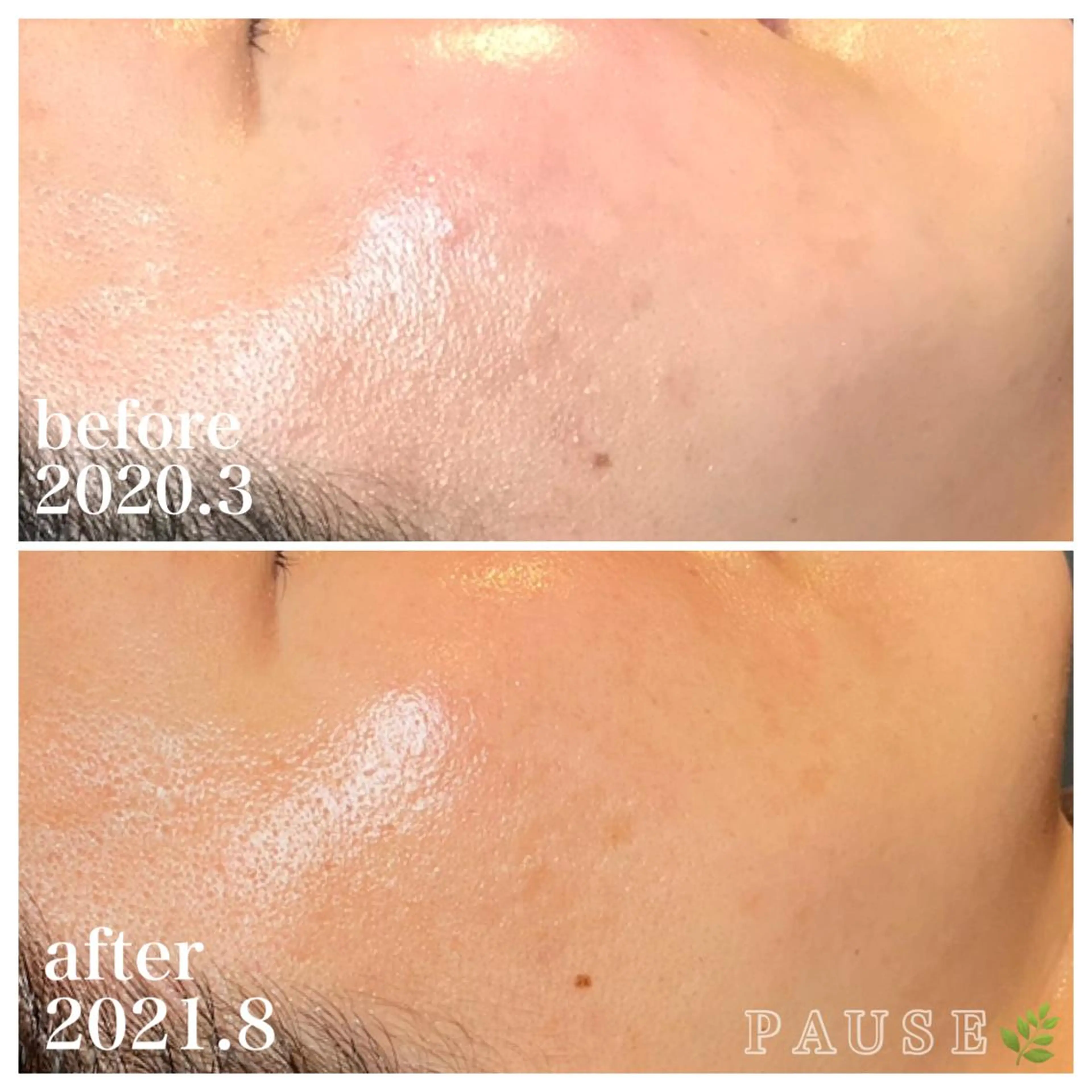 エステ 浜野 恵美のエステ・リラクイメージ