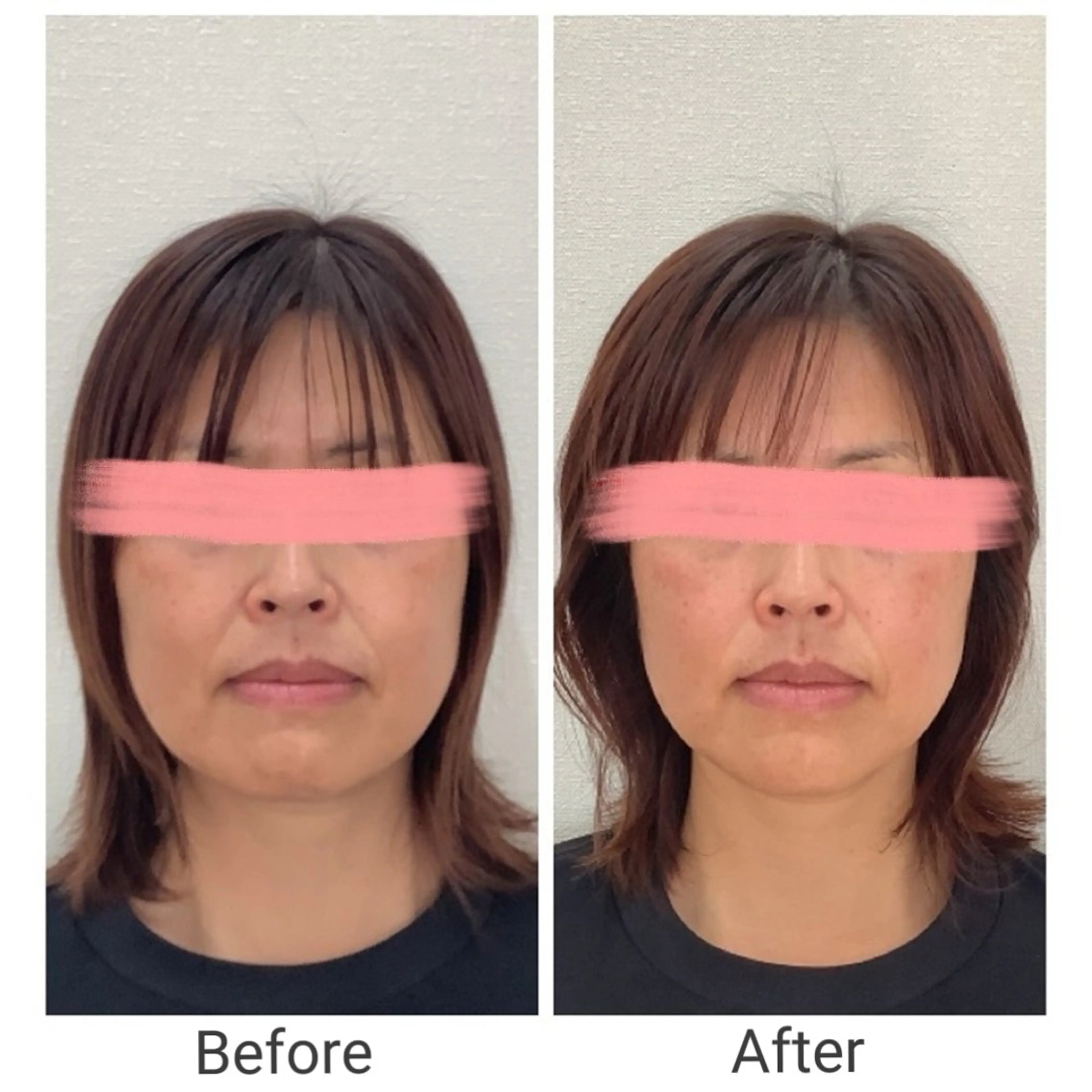 その他 石井 茜のその他イメージ