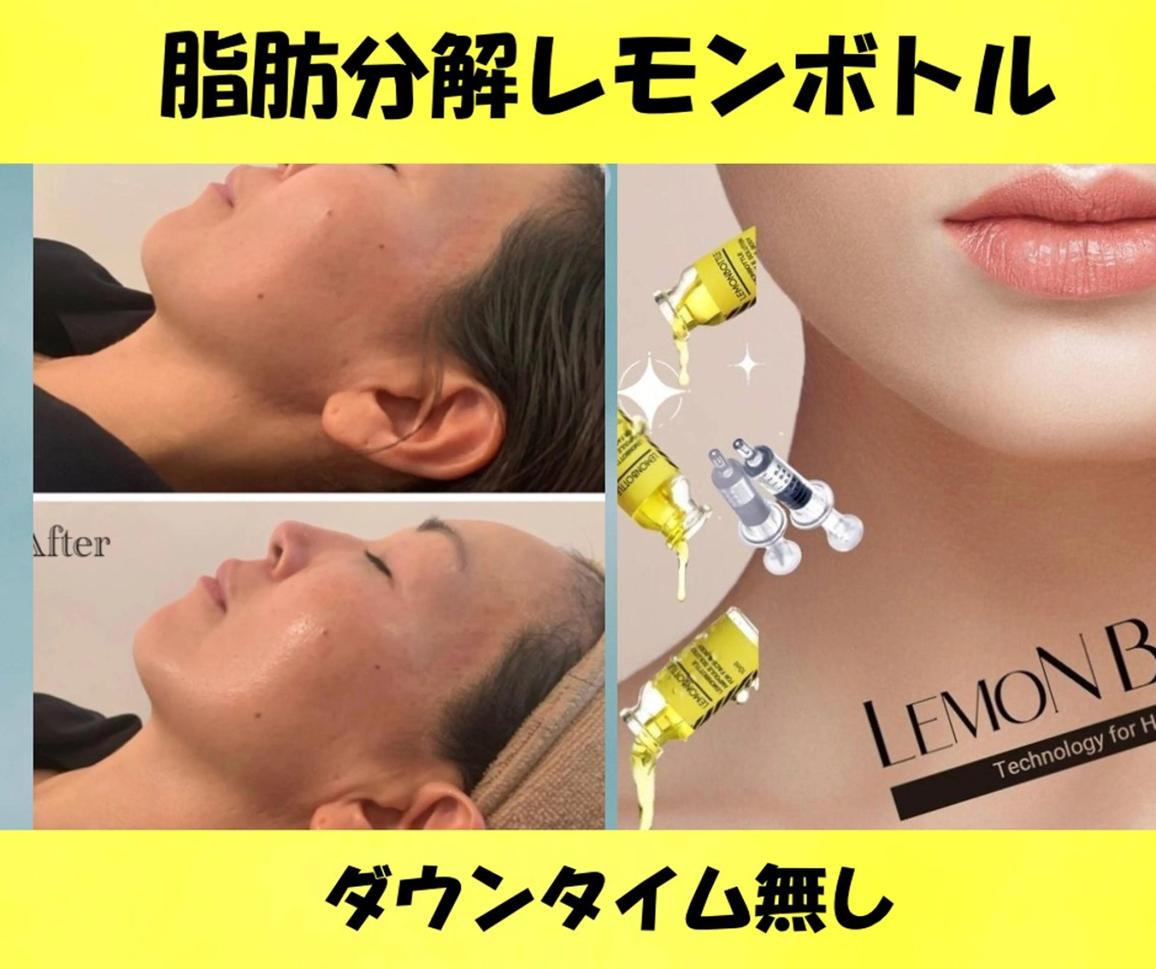 エステ 西区九条エステ MITUREIサロンのエステ・リラクイメージ