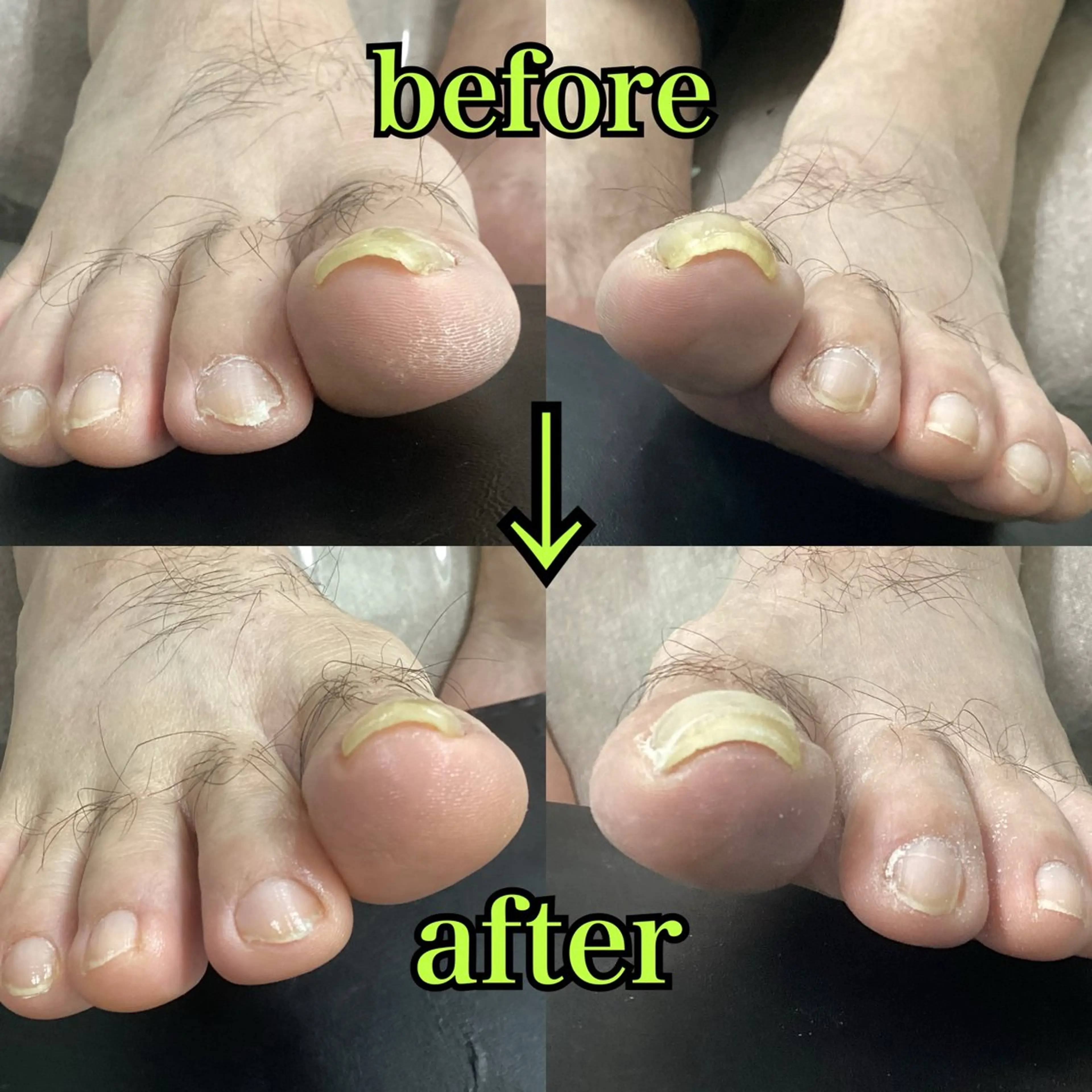 ネイル フットネイル ヒューマン 鍼灸接骨院所属・リラク/ネイル/ 足裏ケア/蛭川栞のエステ・リラクイメージ