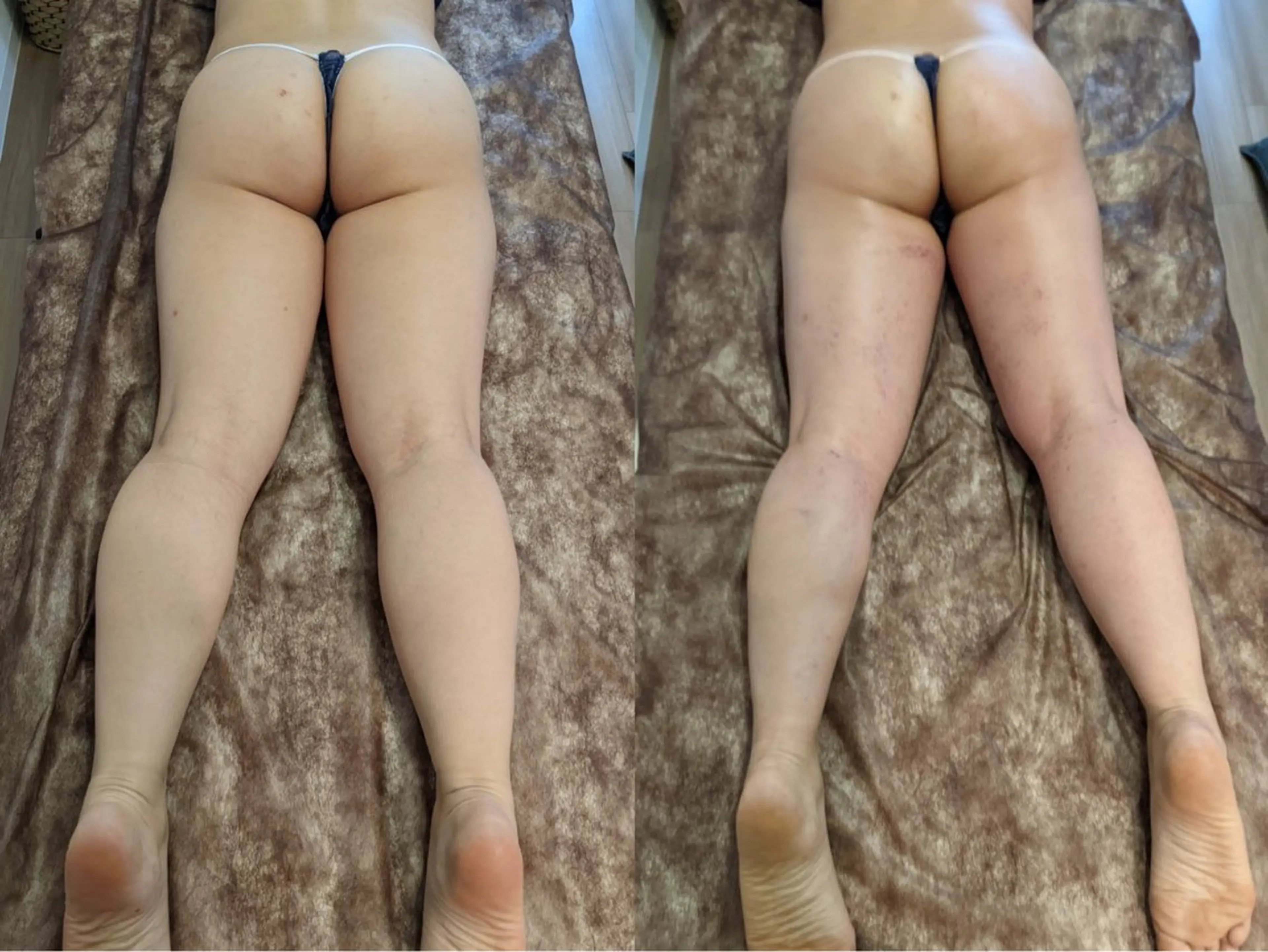 セルライトクラッシュ 腸もみ　bi♡eruのその他イメージ