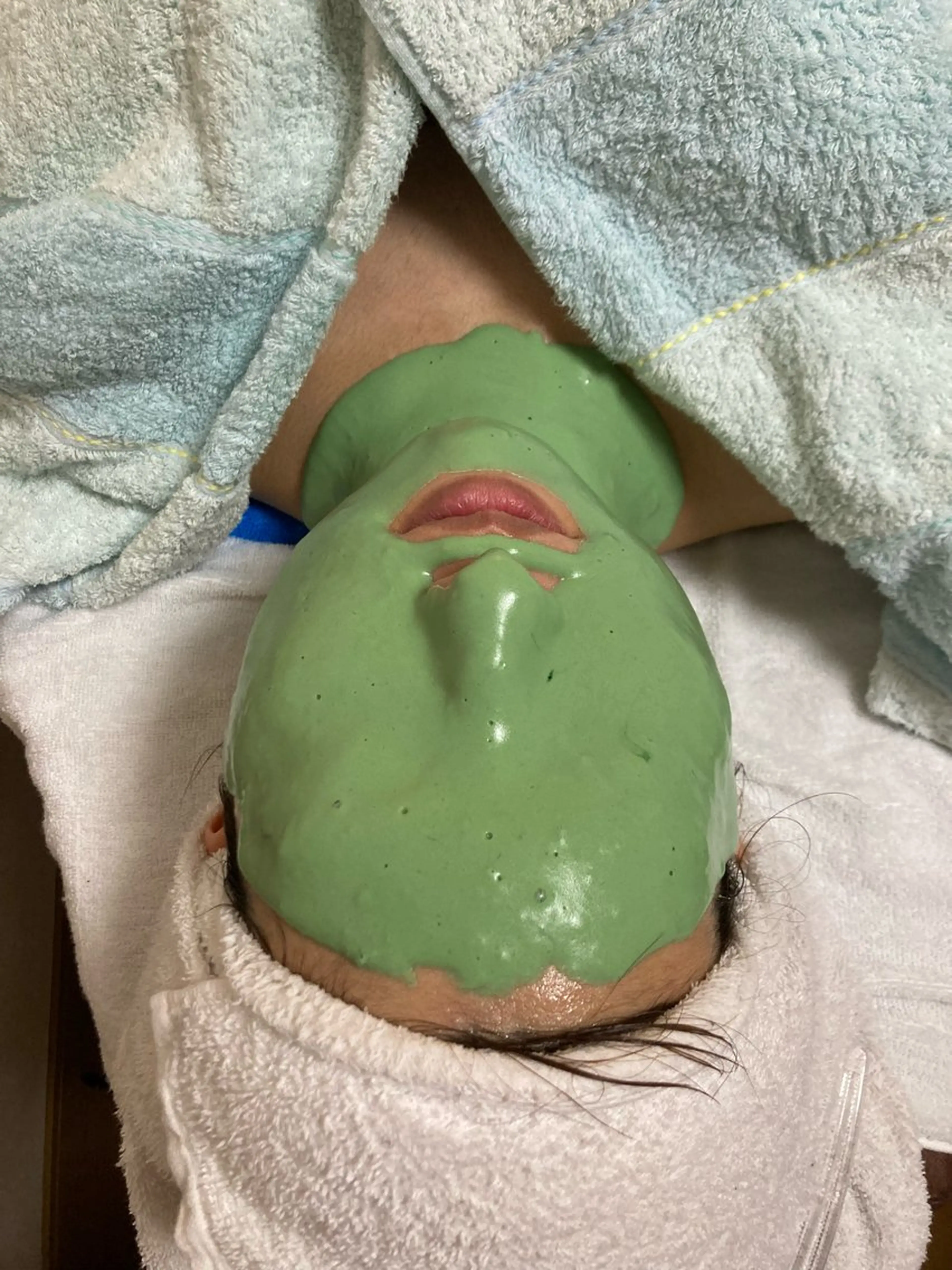 肌荒れにお悩みの方にオススメ🌟アドバンスコース➕ビューネケアパック💚の写真