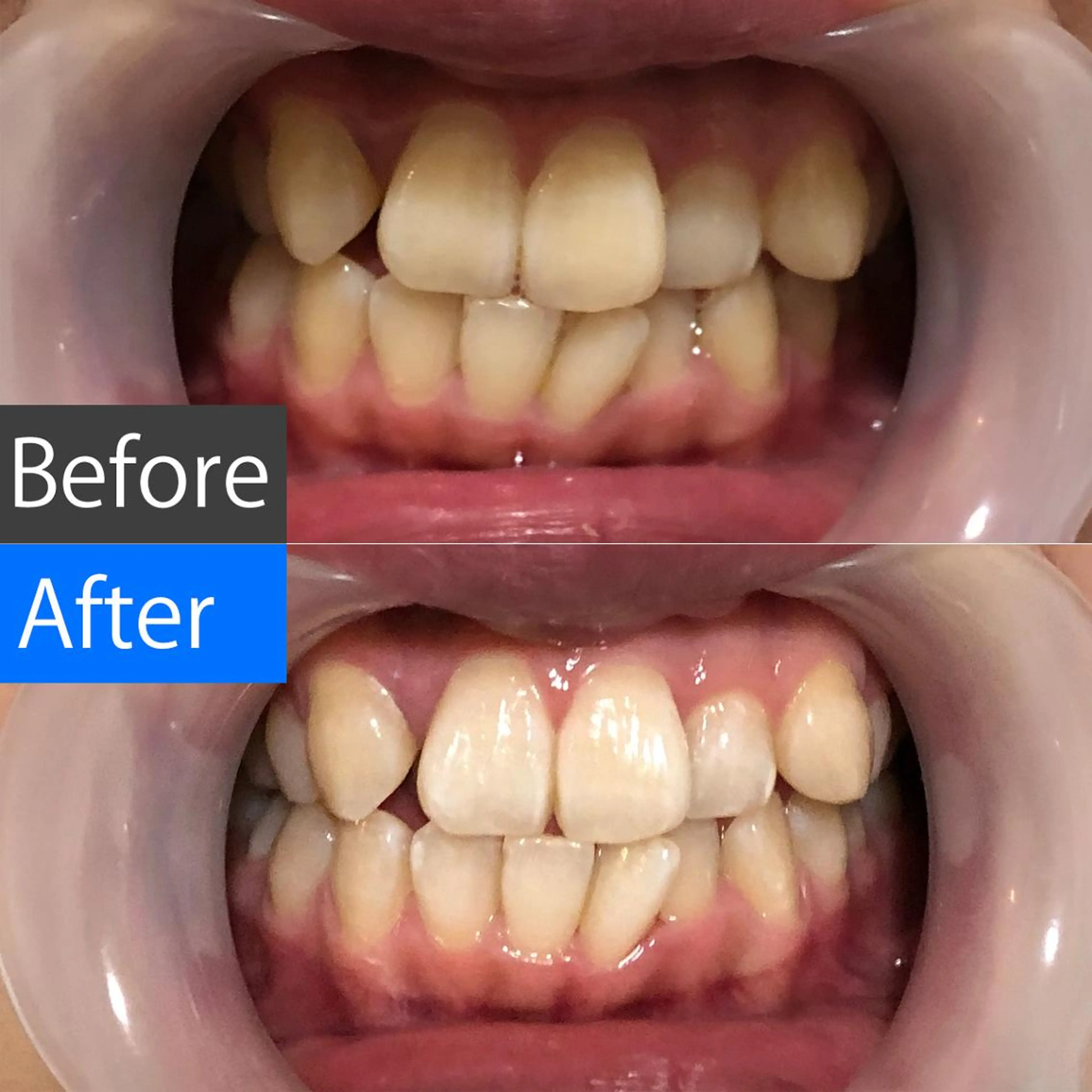 パーマ マツエク・マツパ ミディアム カラー ネイル メンズ キッズ アイブロウ メンズ就活ヘア オフィスネイル ホワイト 中目黒 ホワイトニングサロンのその他イメージ