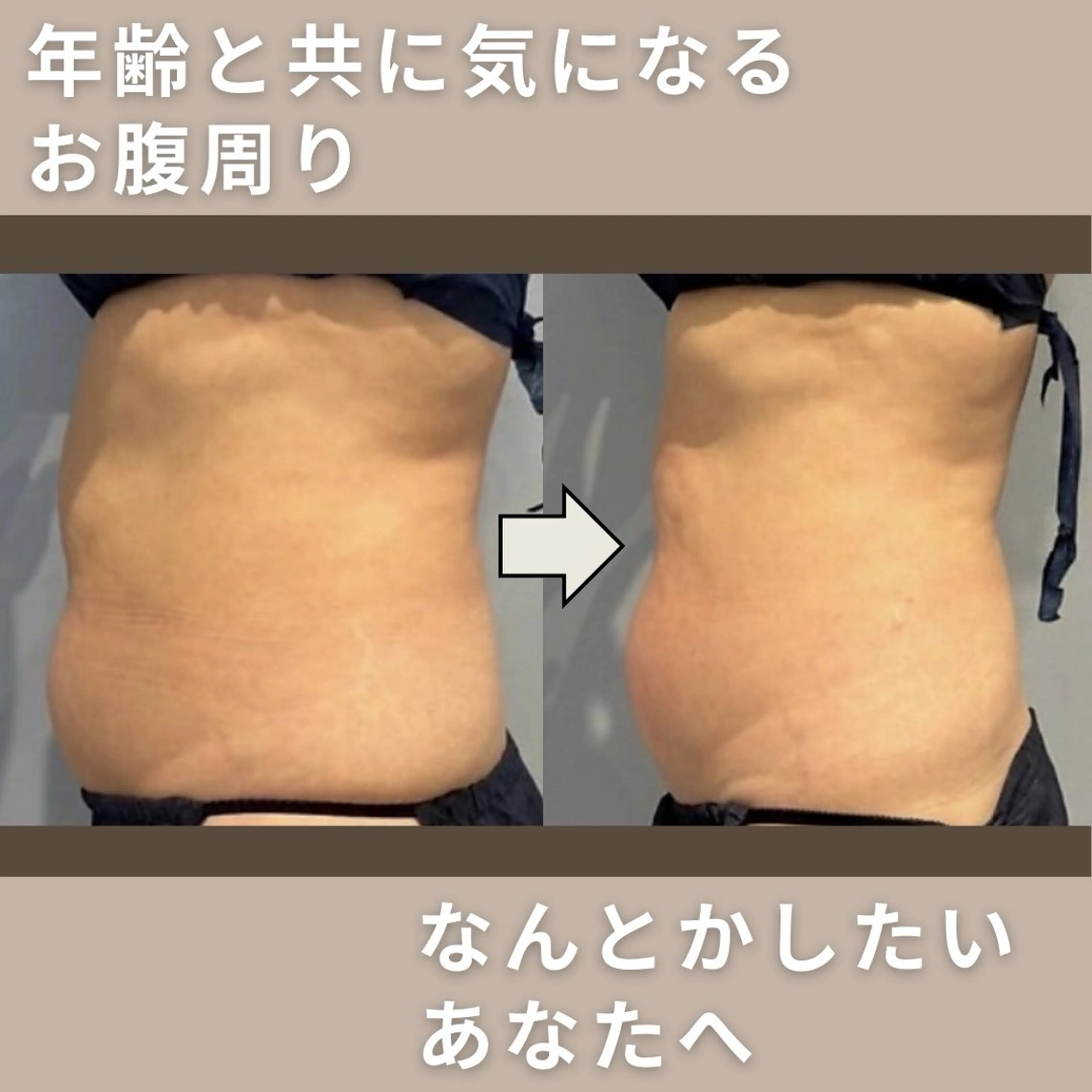 脂肪コントロール（A4サイズ）高濃度特許成分配合【お腹、太もも】気になる部分を徹底ケア！の写真