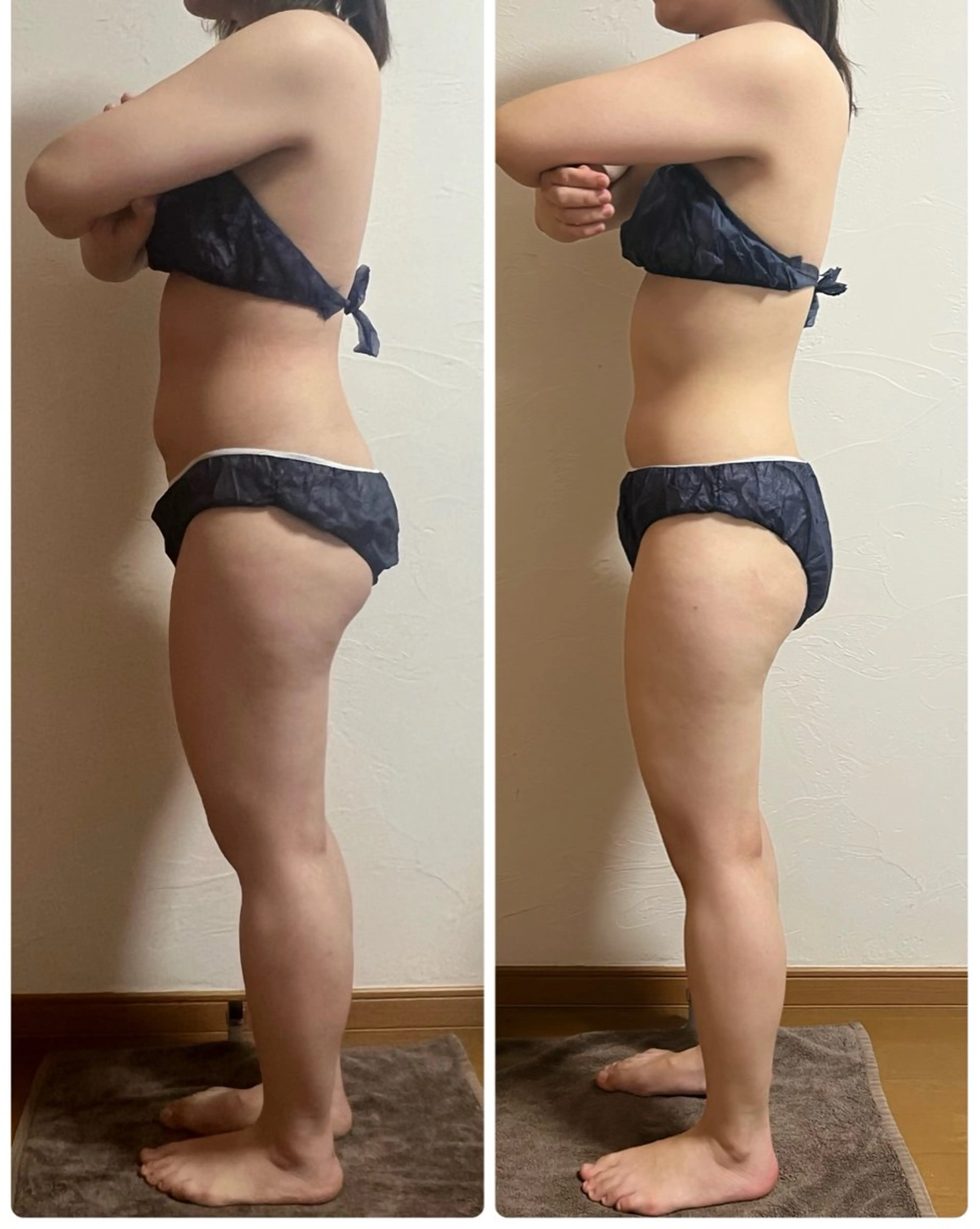 【新規】1度体験してみてください！！1台で超音波EMSキャビテーションを同時に施術可能☆全身90分コースの写真