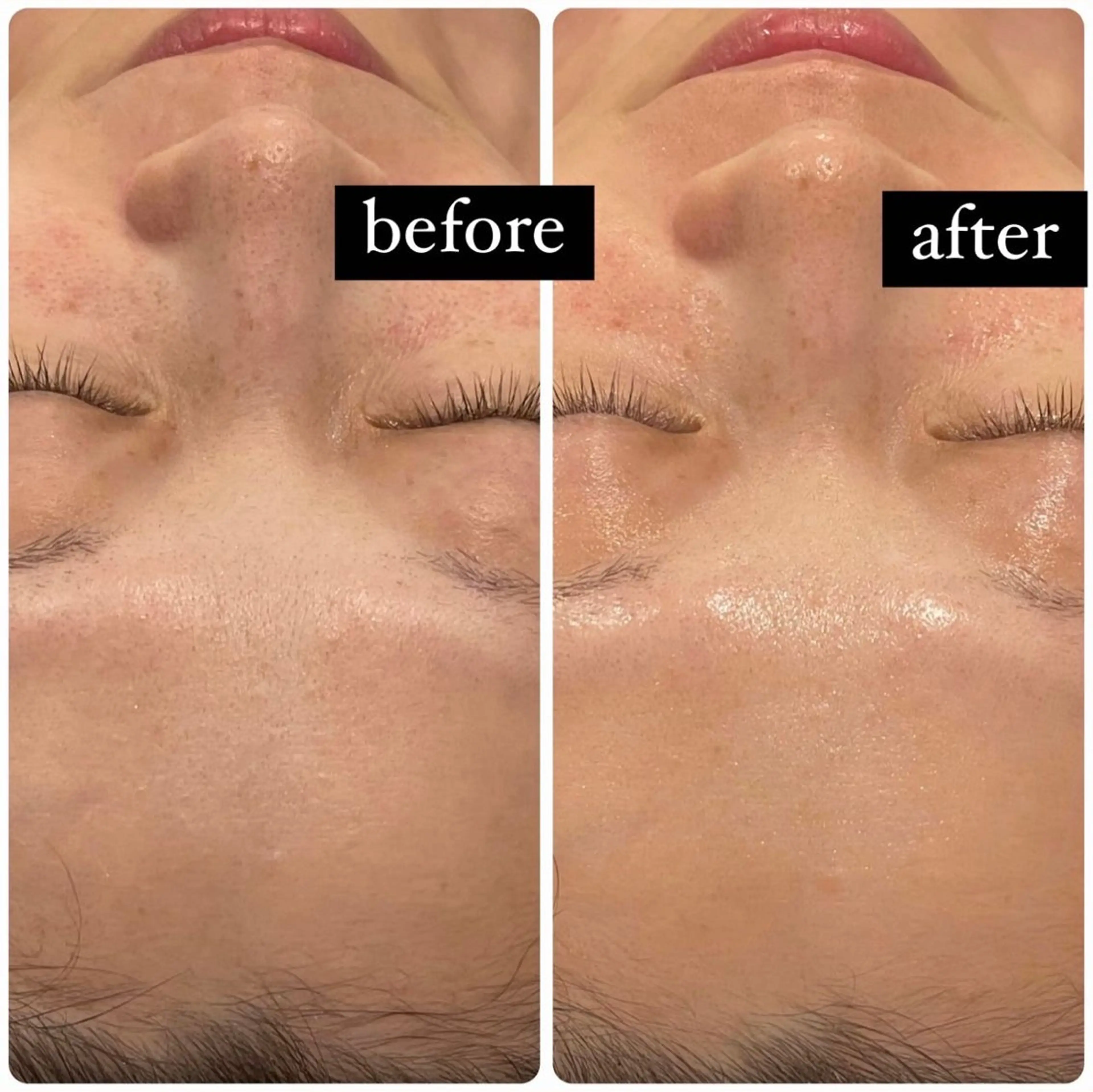 立体小顔×艶肌×美ボ ディ似合わせ施術 岡のエステ・リラクイメージ