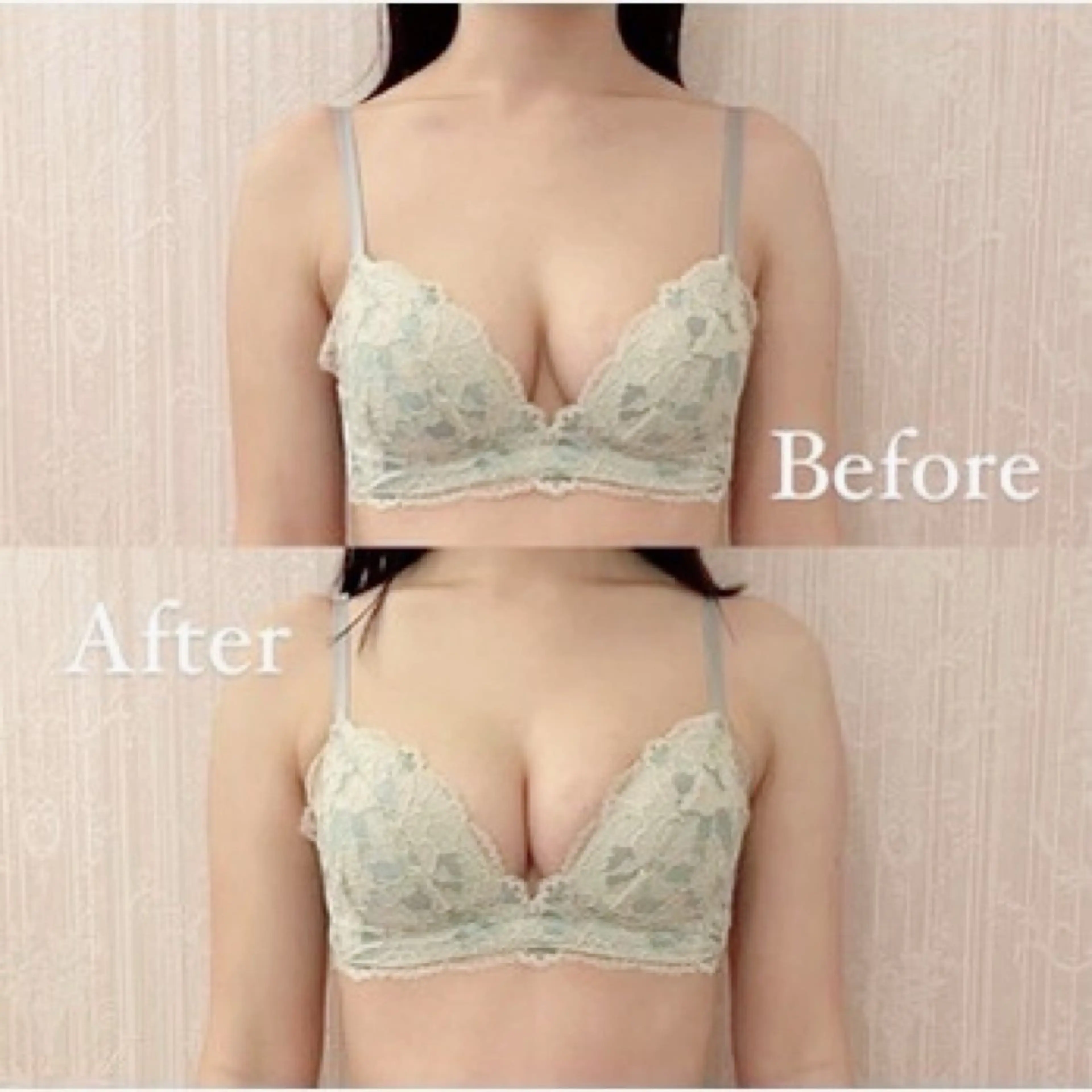 【左右差・離れ】お悩みバストケアの写真