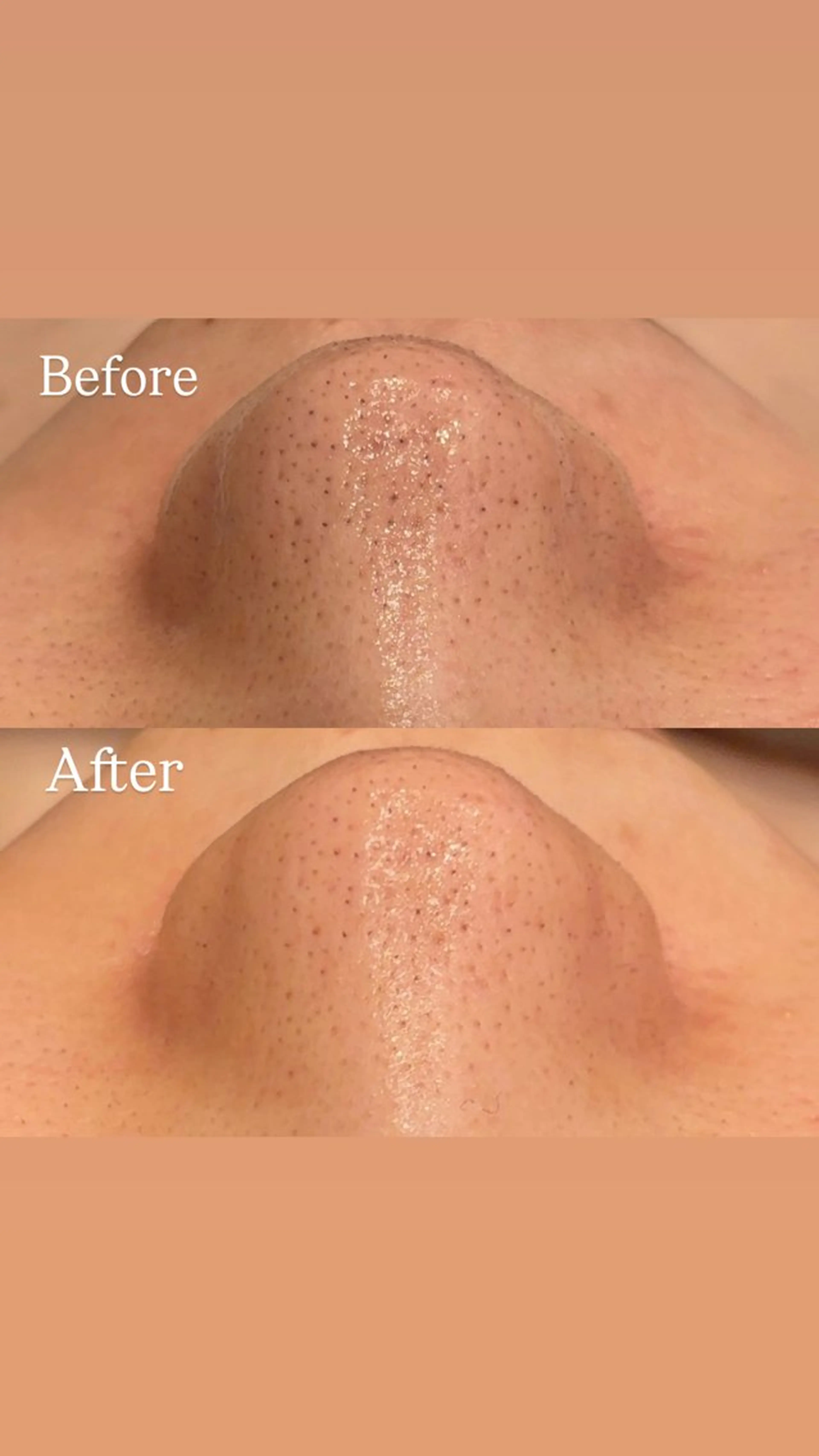 Hari Lounge恵比寿所属・chika🦋 ハリラウンジ恵比寿のエステ・リラクイメージ