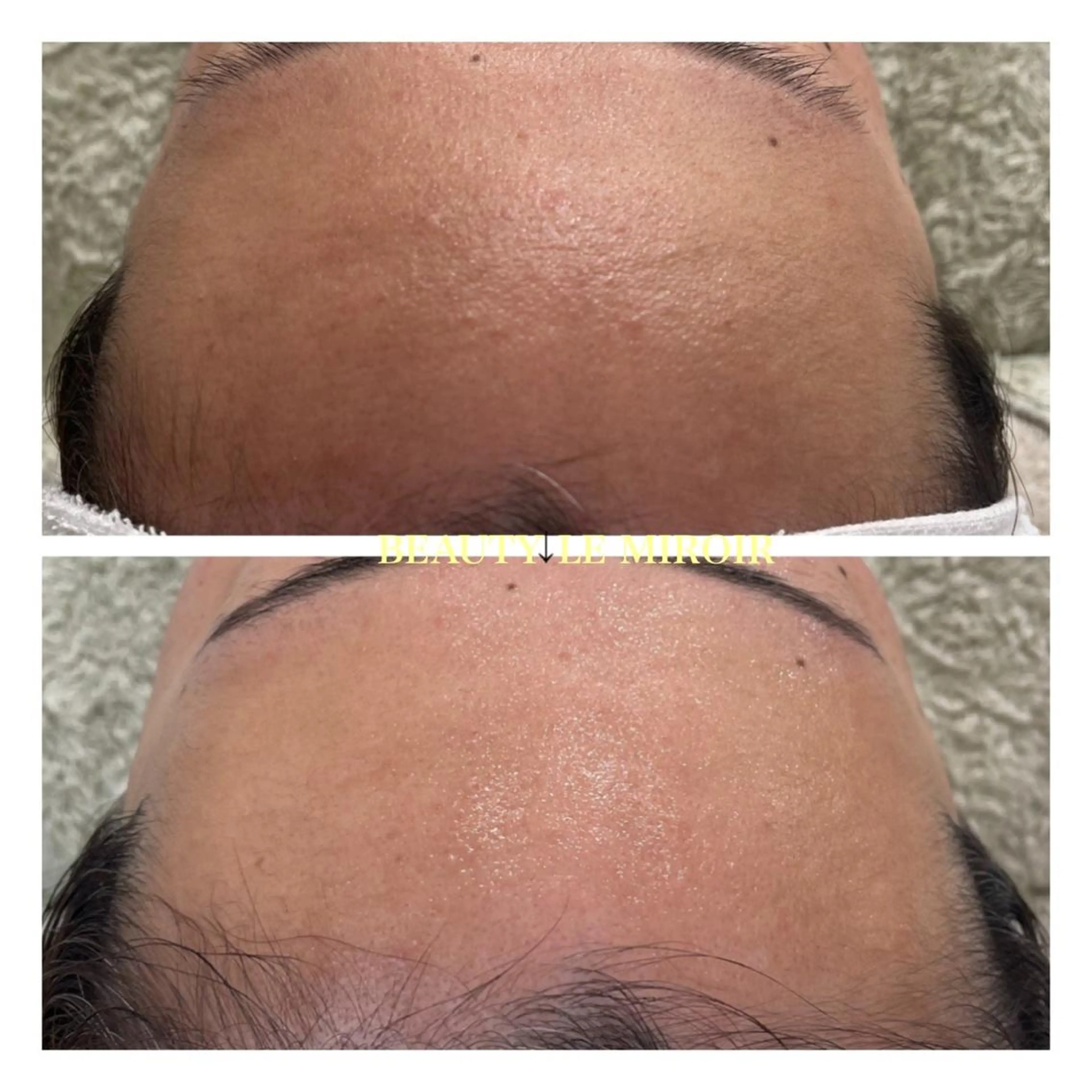 ビューティー ミロワールのエステ・リラクイメージ