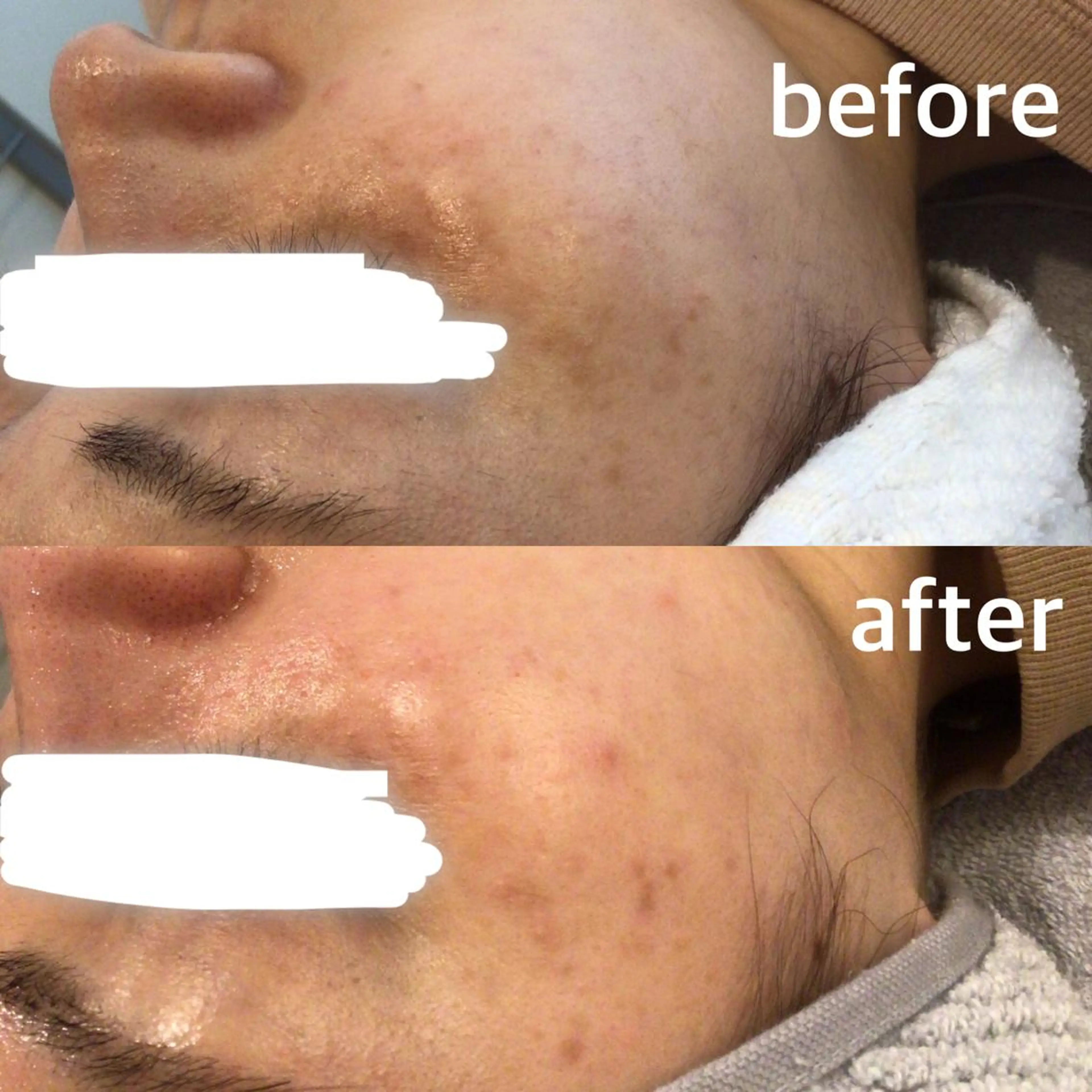 エステ Porte beauteオーナーのエステ・リラクイメージ