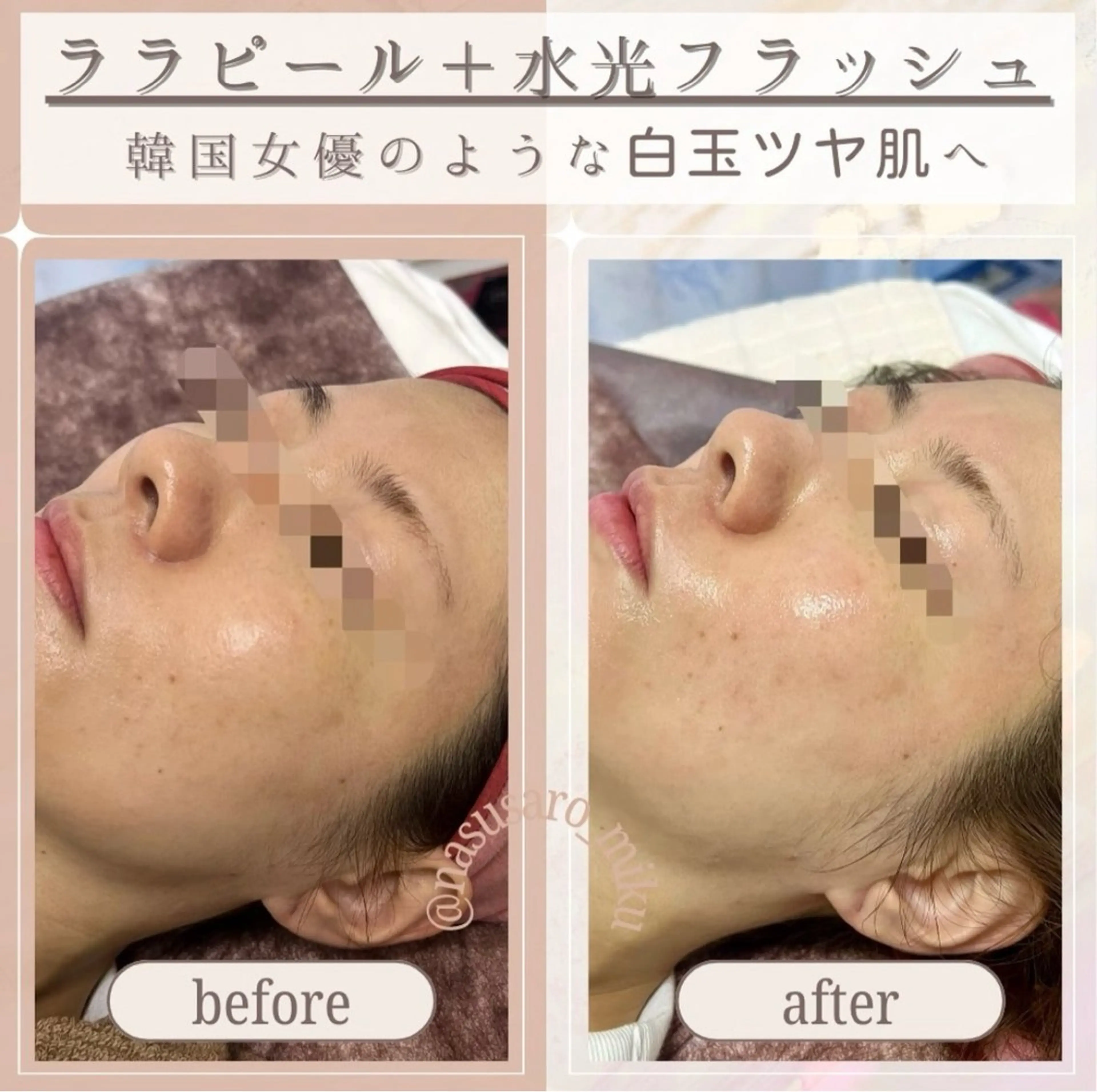 🎀韓国式肌改善🎀 Miku🇰🇷💎のその他イメージ