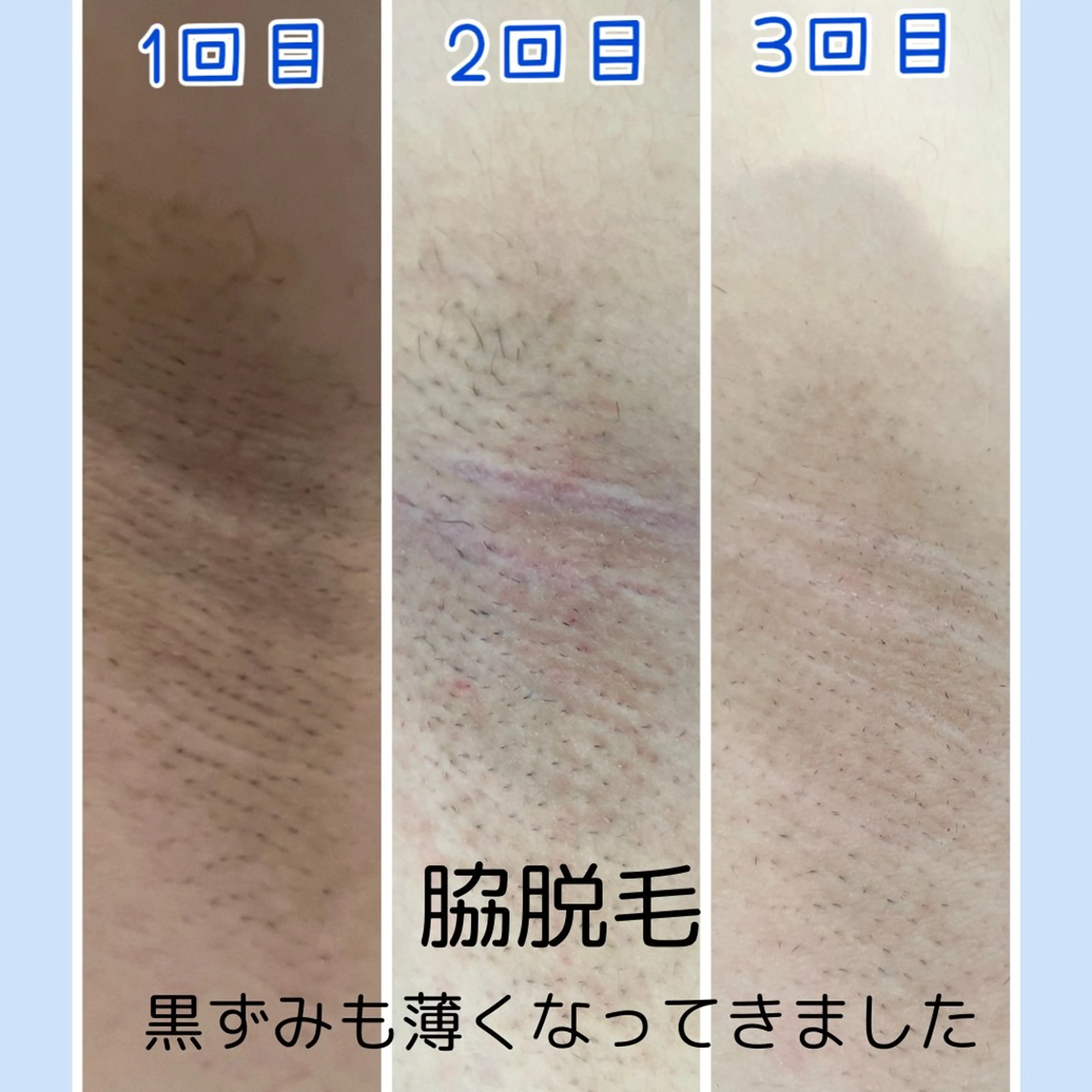 脱毛 Mia.rosa所属・光フェイシャル・脱毛 MIA.ROSAの眉毛・アイブロウイメージ