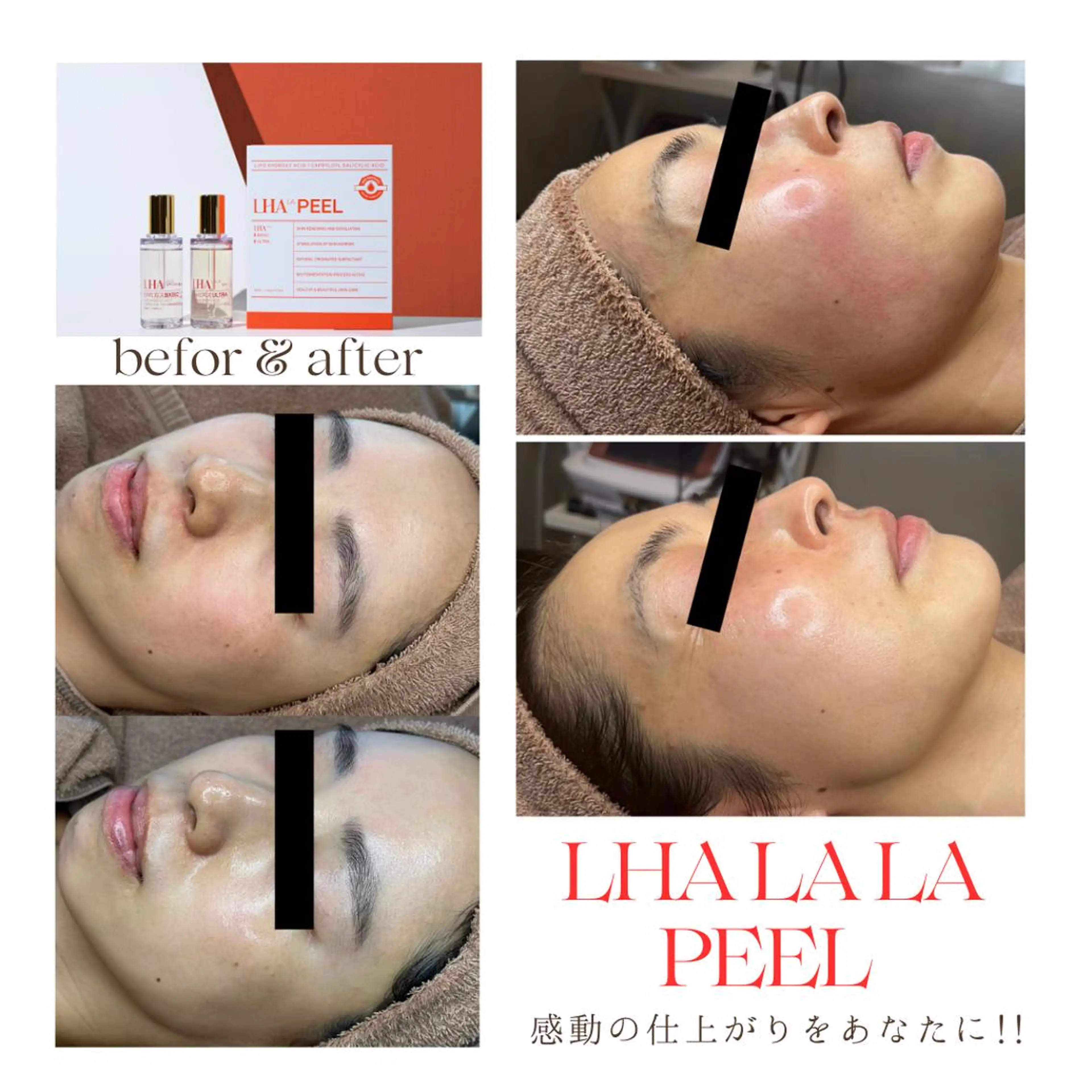 【感動のハリ・ツヤ】 美肌＆脱毛SPICAのエステ・リラクイメージ