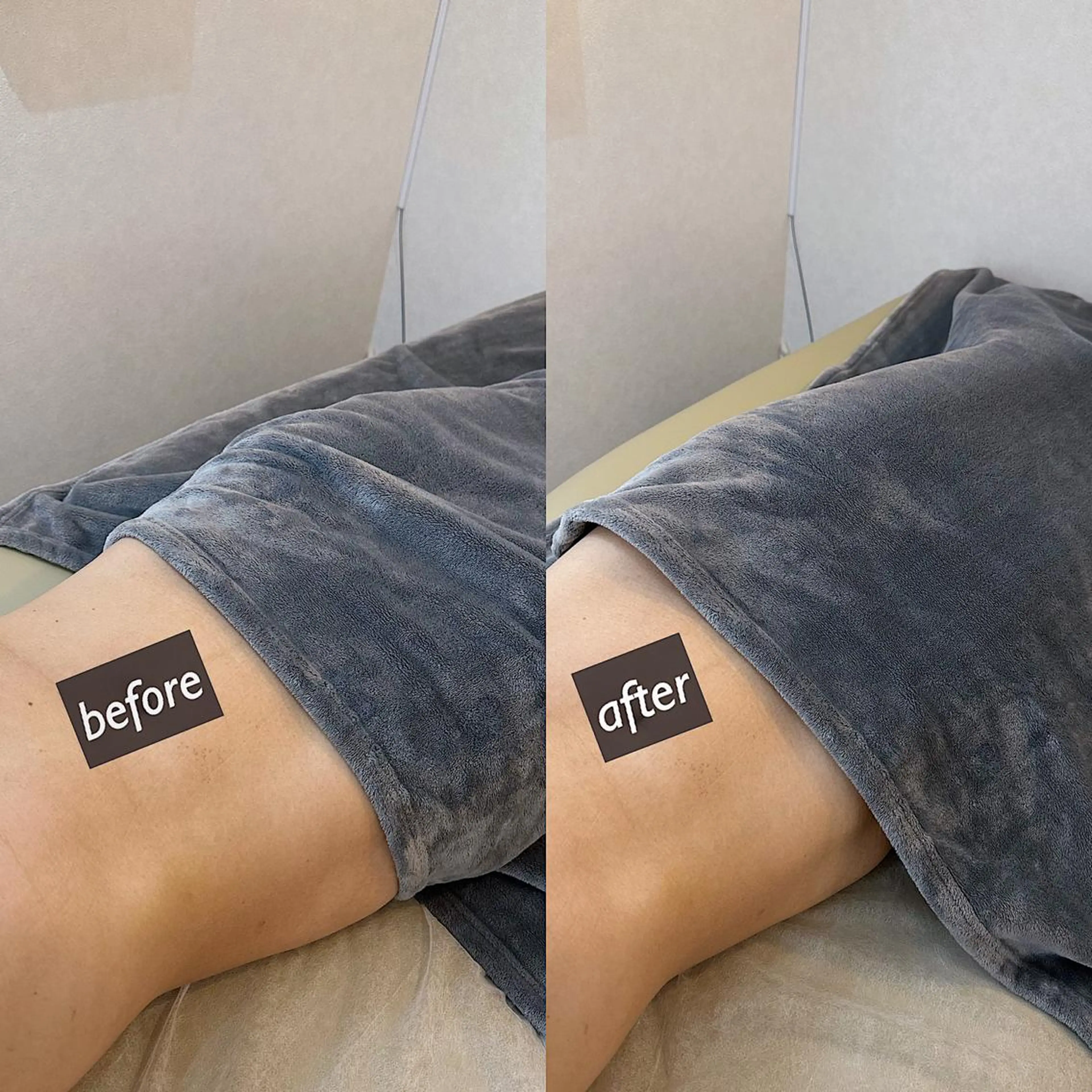 うなじ脱毛/美肌脱毛 LABELのエステ・リラクイメージ