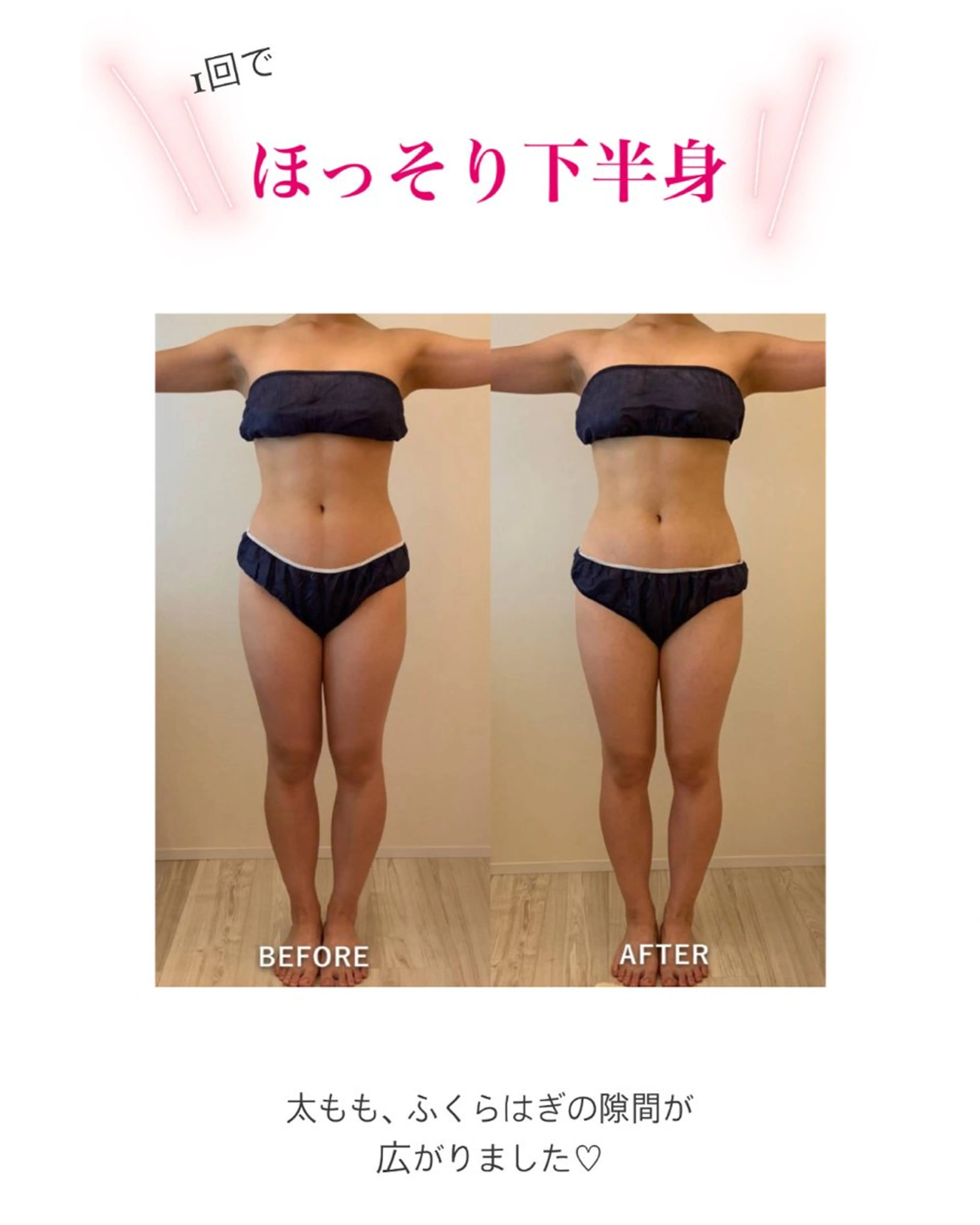 産後ダイエット−9㎏ Pourvous結衣のエステ・リラクイメージ