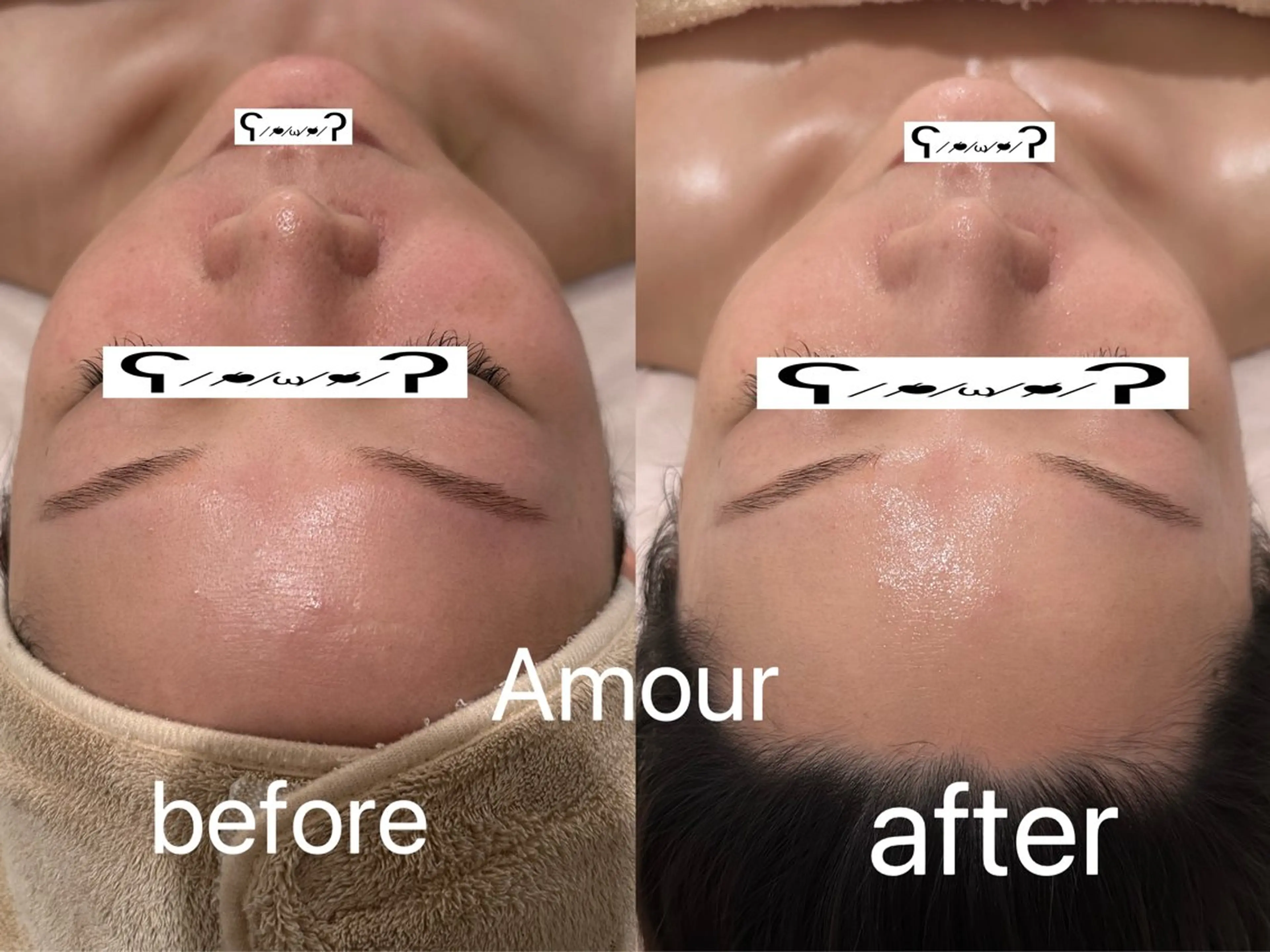 痩身・小顔・脱毛・ オイル&Amourのエステ・リラクイメージ