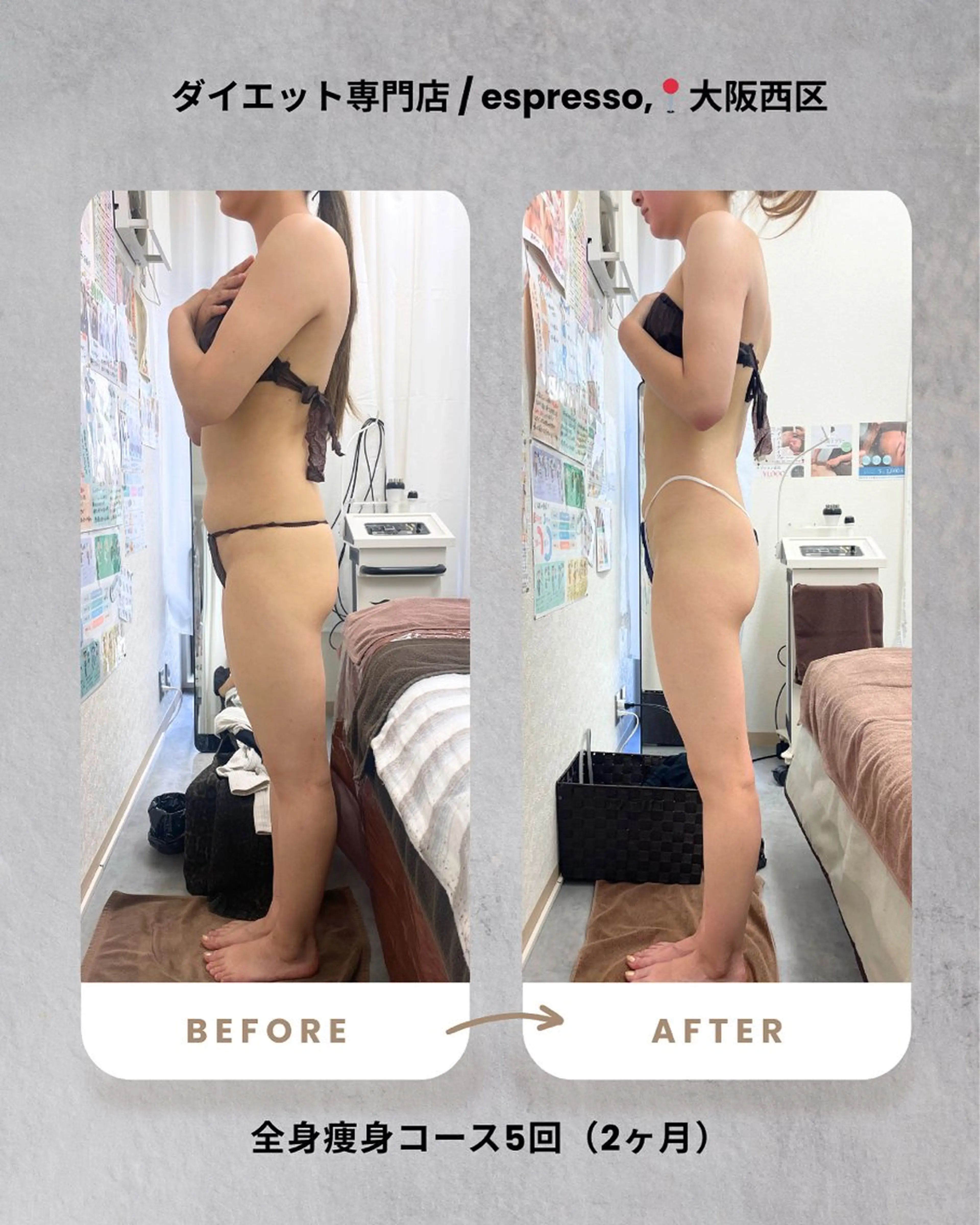 エステ リラク espresso,所属・《痩身、小顔専門店》 エスプレッソのエステ・リラクイメージ