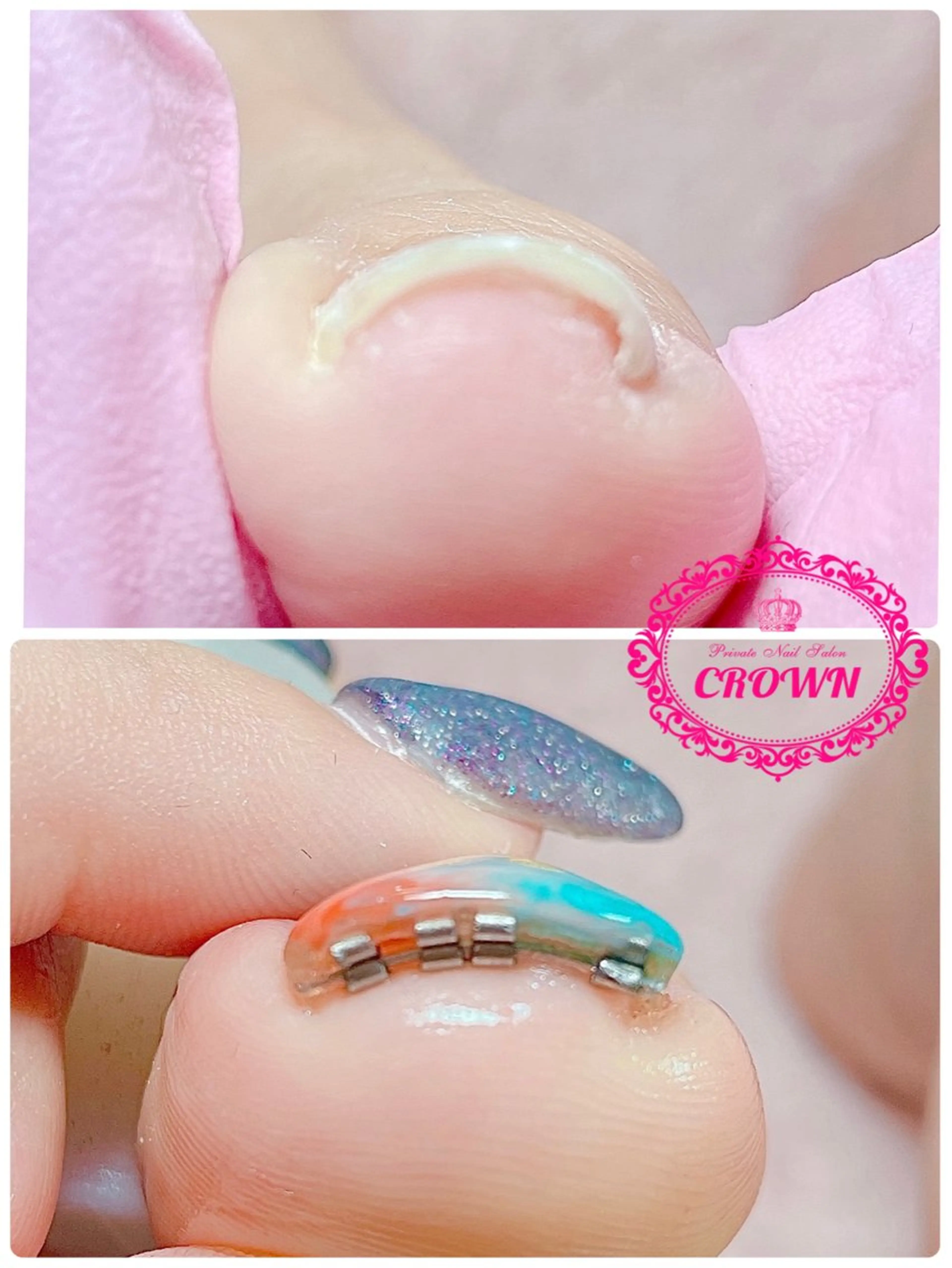 ネイル CROWN プライベートサロンのネイルデザイン