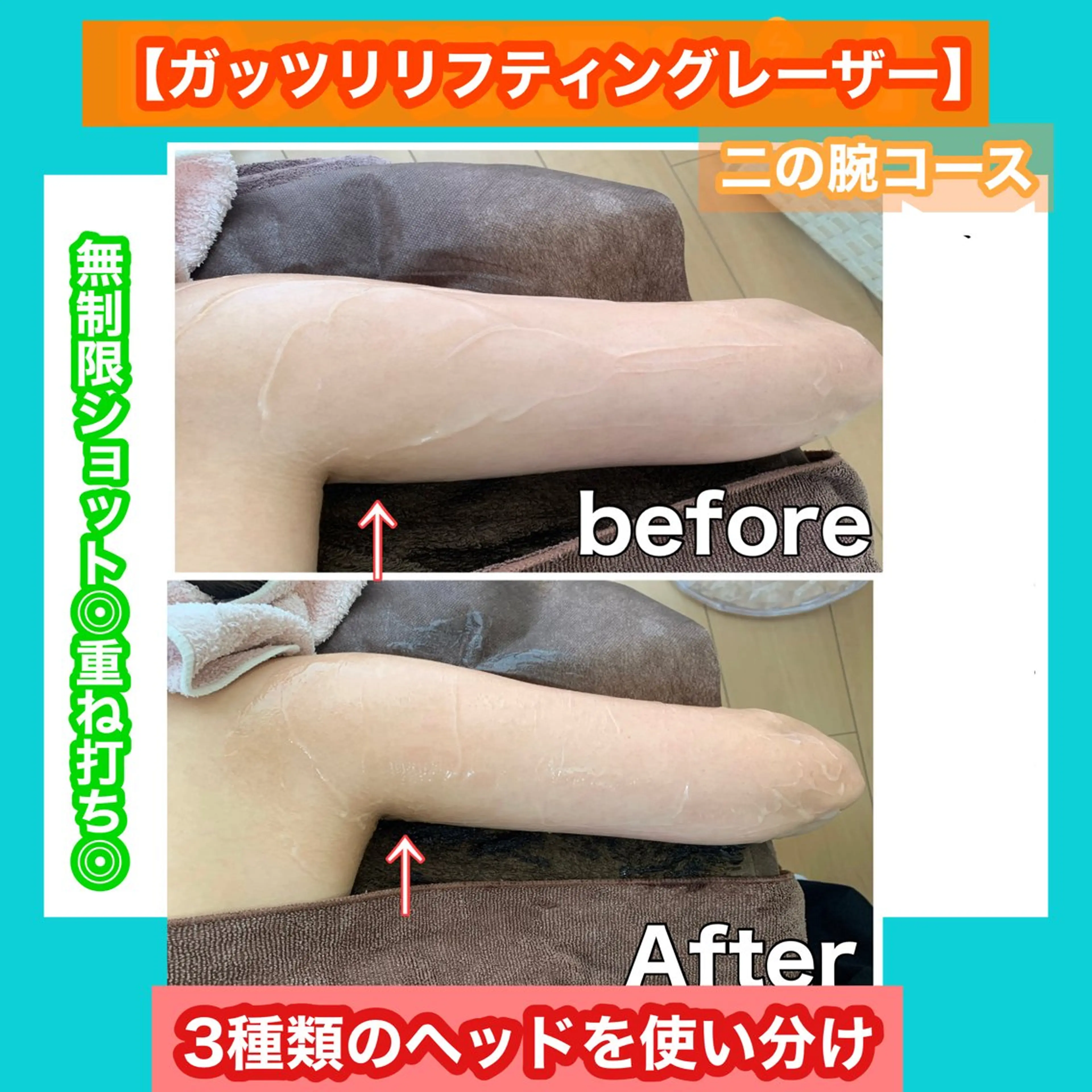 エステ 痩身/脱毛/ネイル HARUKAのエステ・リラクイメージ