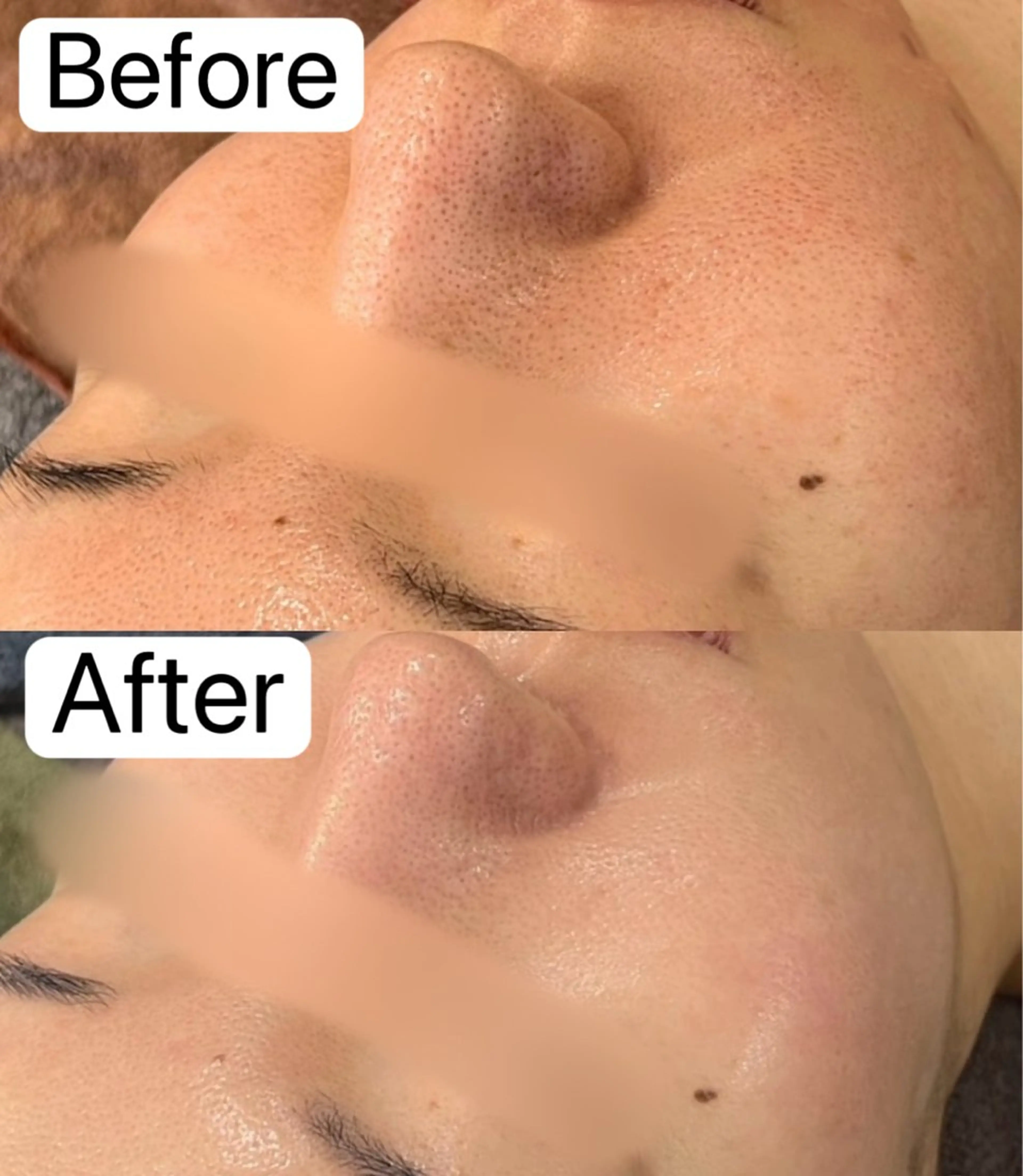 Belle原宿所属・佐藤 加奈のエステ・リラクイメージ