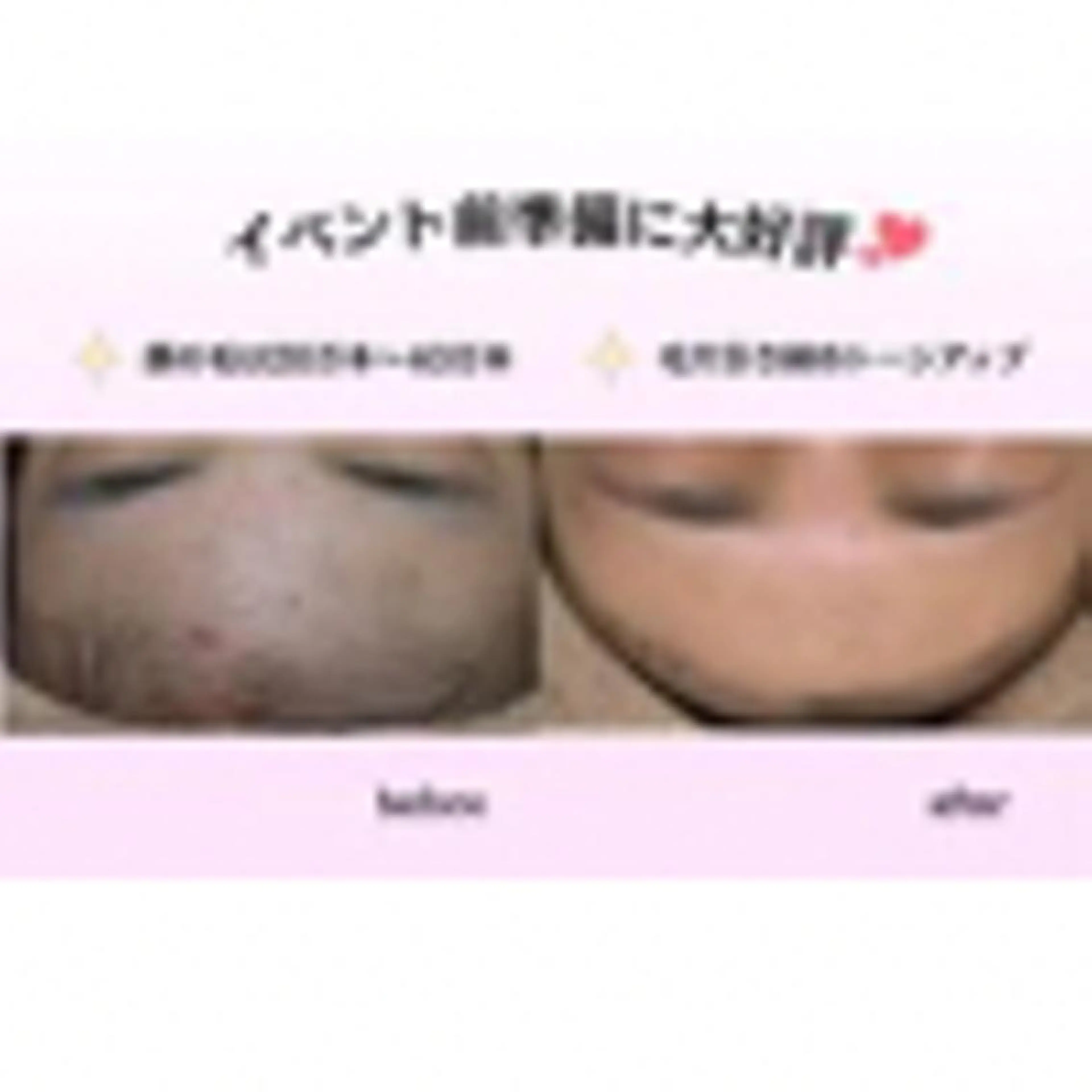 🌿小顔・痩身・脱毛 レイビス川崎店🌿のエステ・リラクイメージ