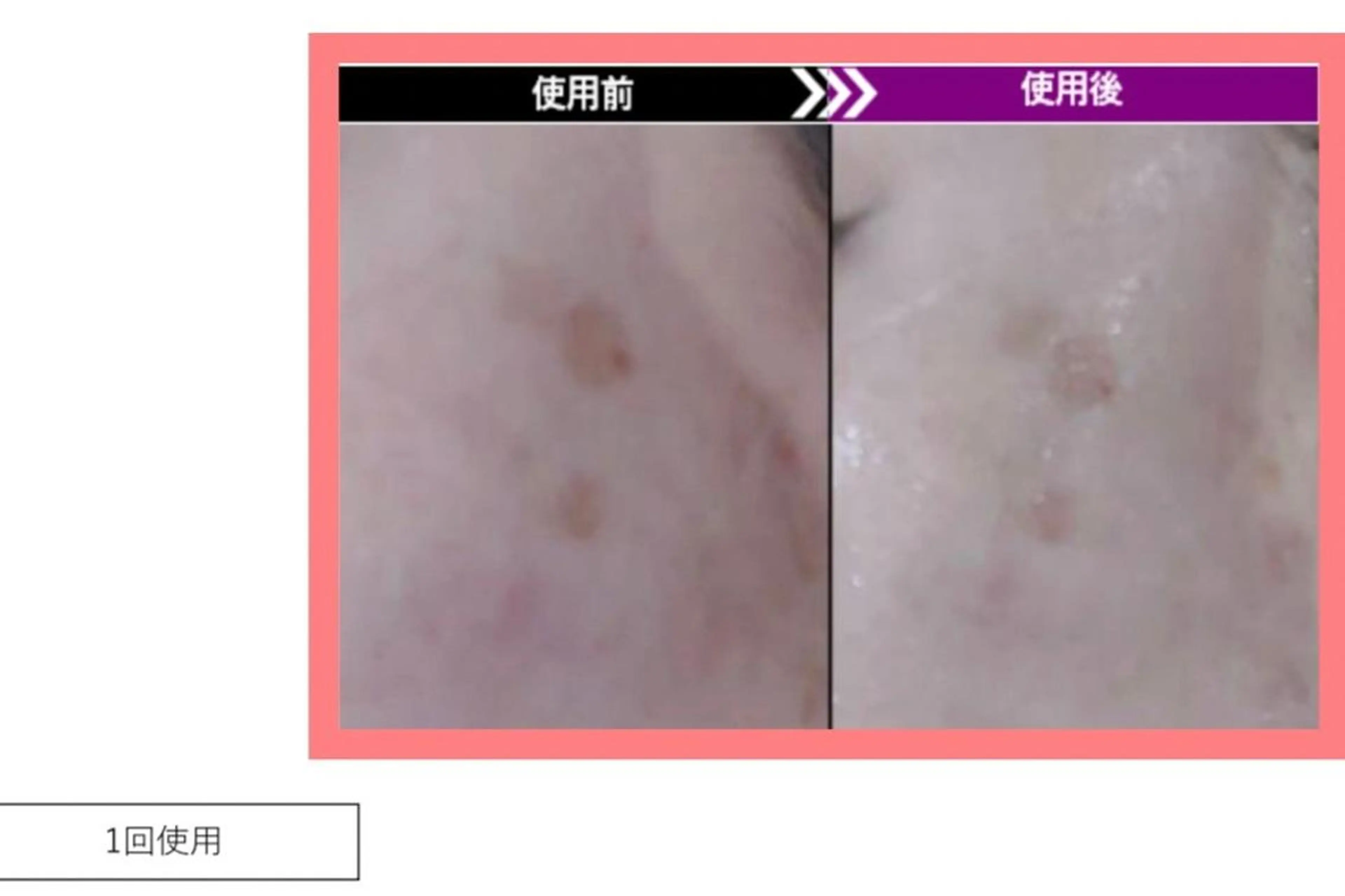 エステ 大林 聖子のエステ・リラクイメージ