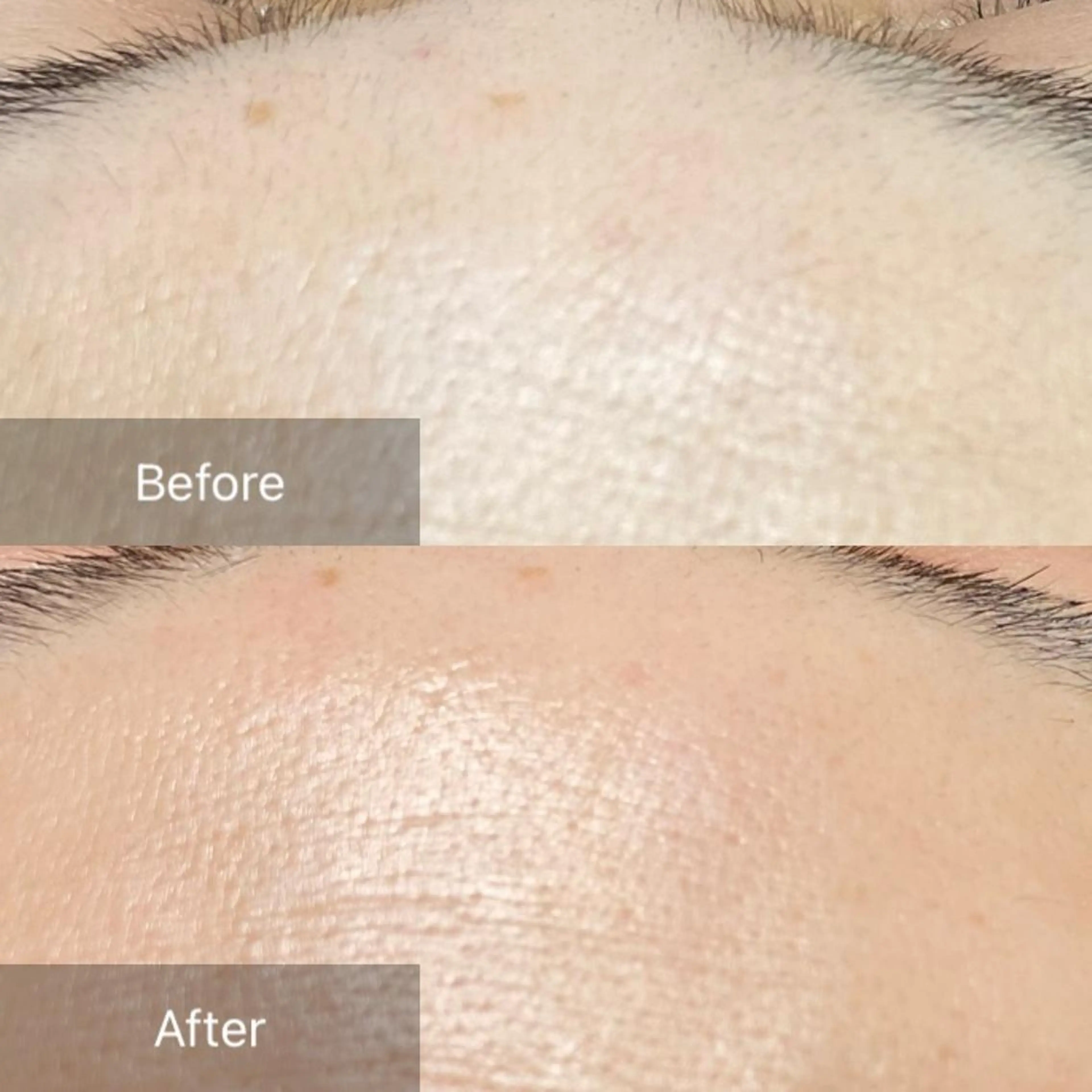 脱毛 産毛専門店 Bittoのエステ・リラクイメージ