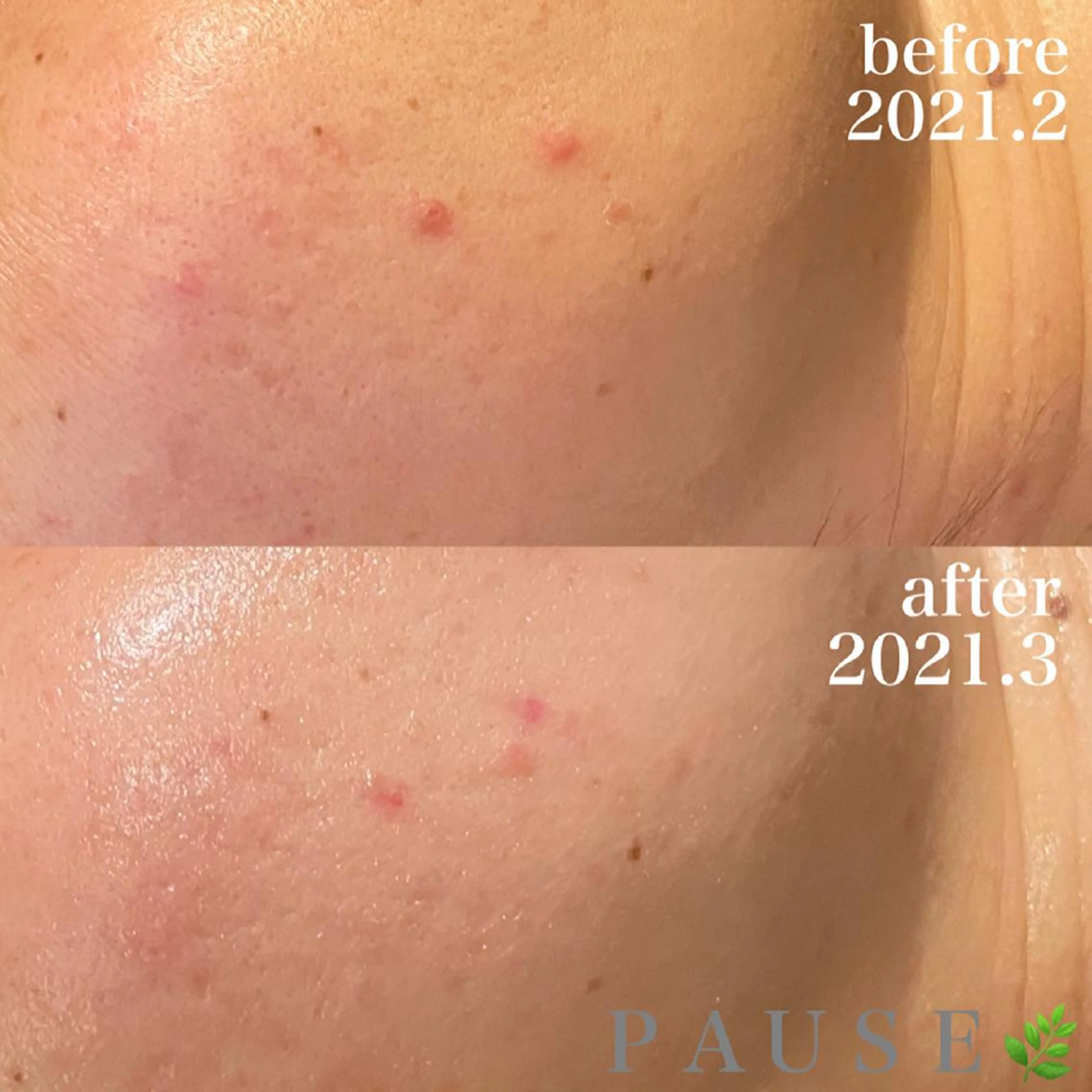 エステ 浜野 恵美のエステ・リラクイメージ