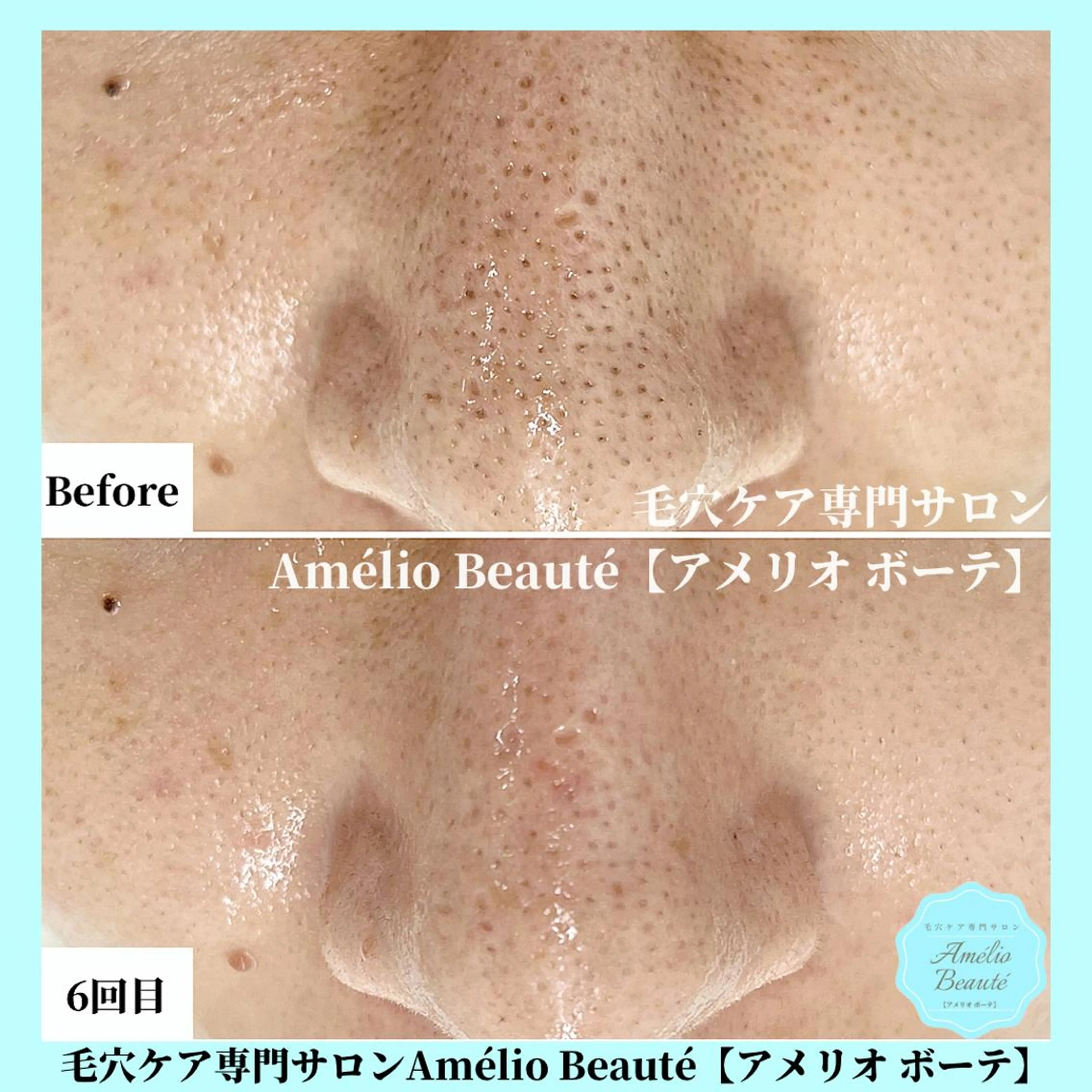 毛穴ケア専門サロン Amélio Beauté所属・毛穴ケア専門サロン アメリオボーテのその他イメージ