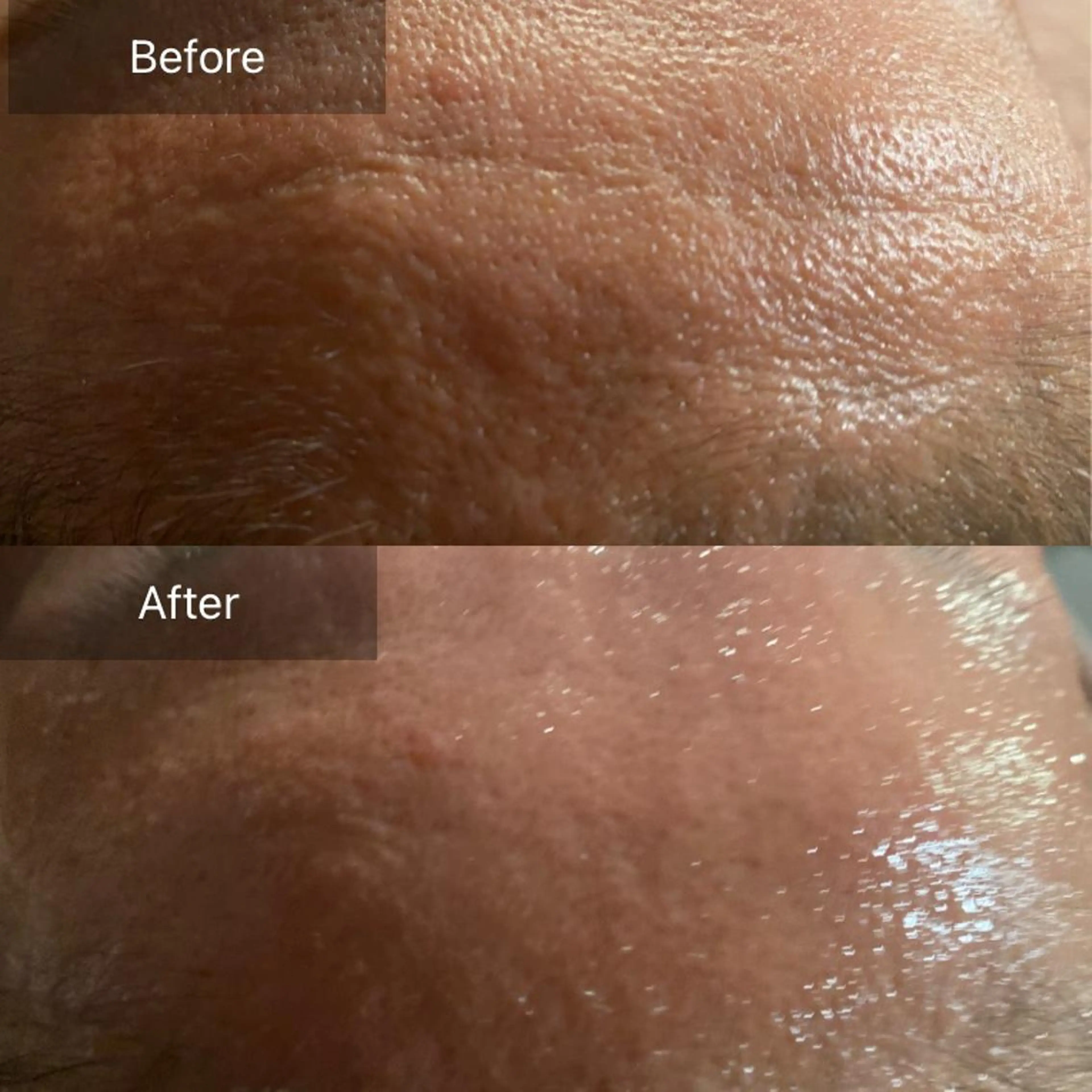 Mandarin Orange所属・毛穴から始める肌メン テマンダリンオレンジのエステ・リラクイメージ