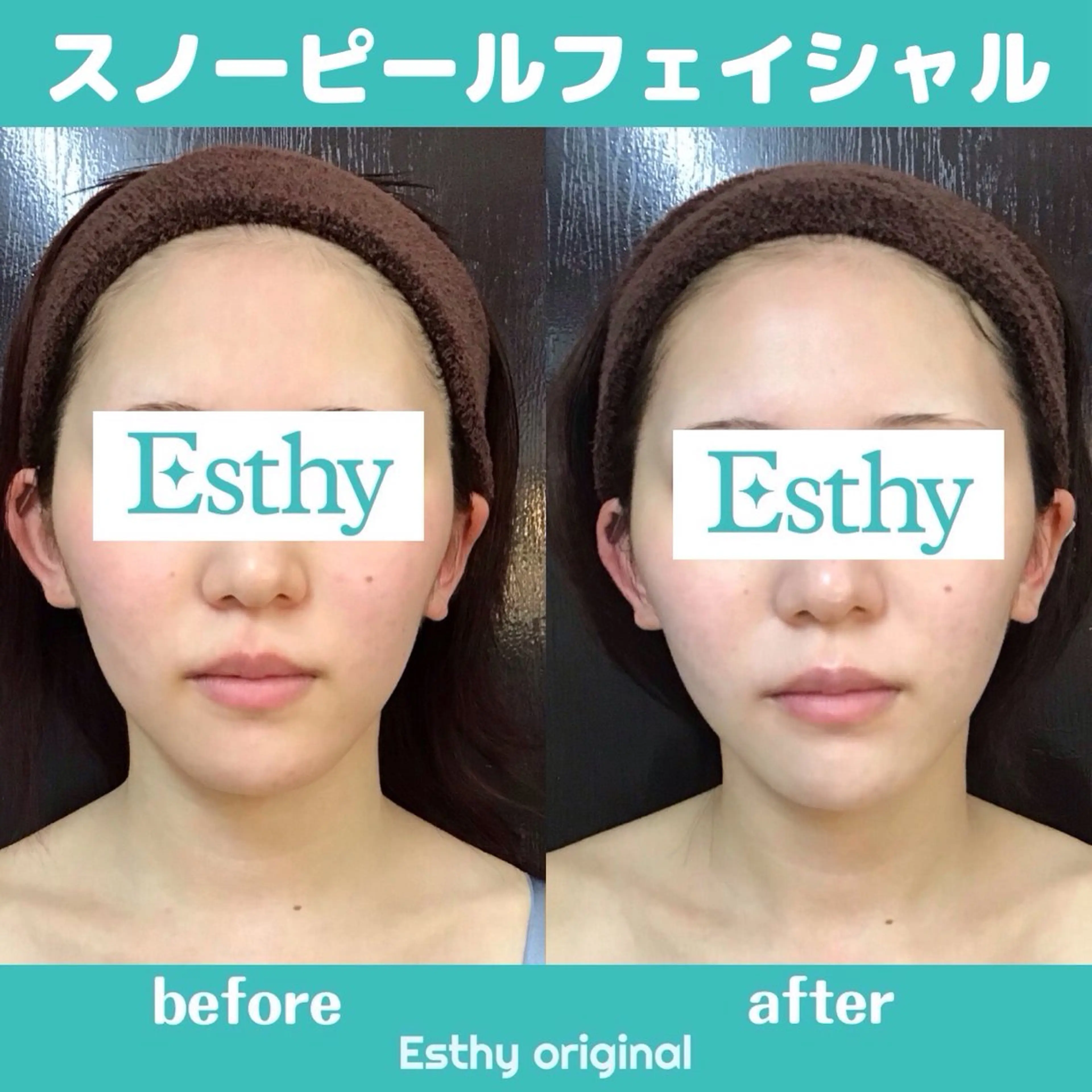 エスティ 南越谷店のエステ・リラクイメージ