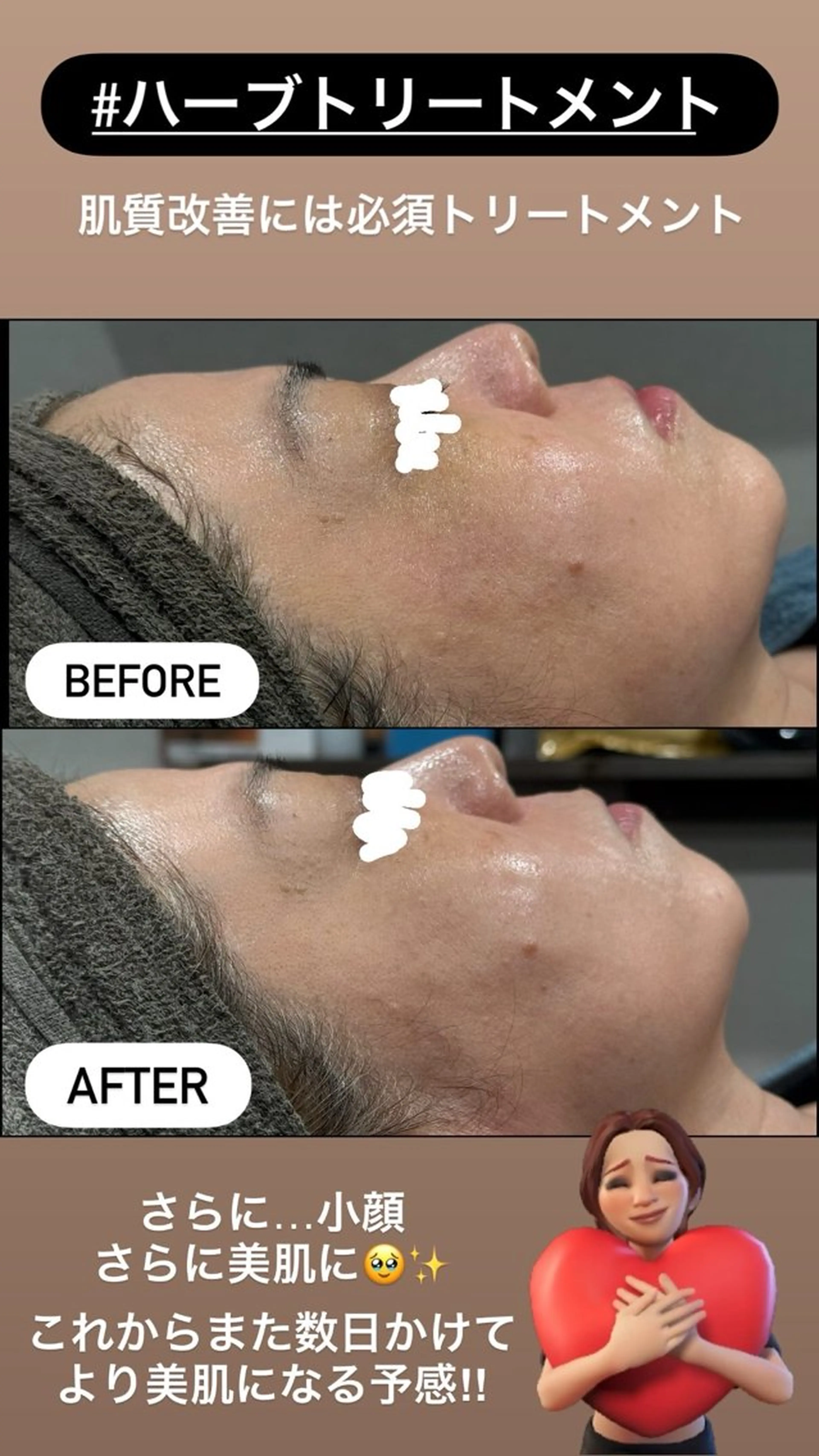 エステ LiZA エステティックサロンのエステ・リラクイメージ