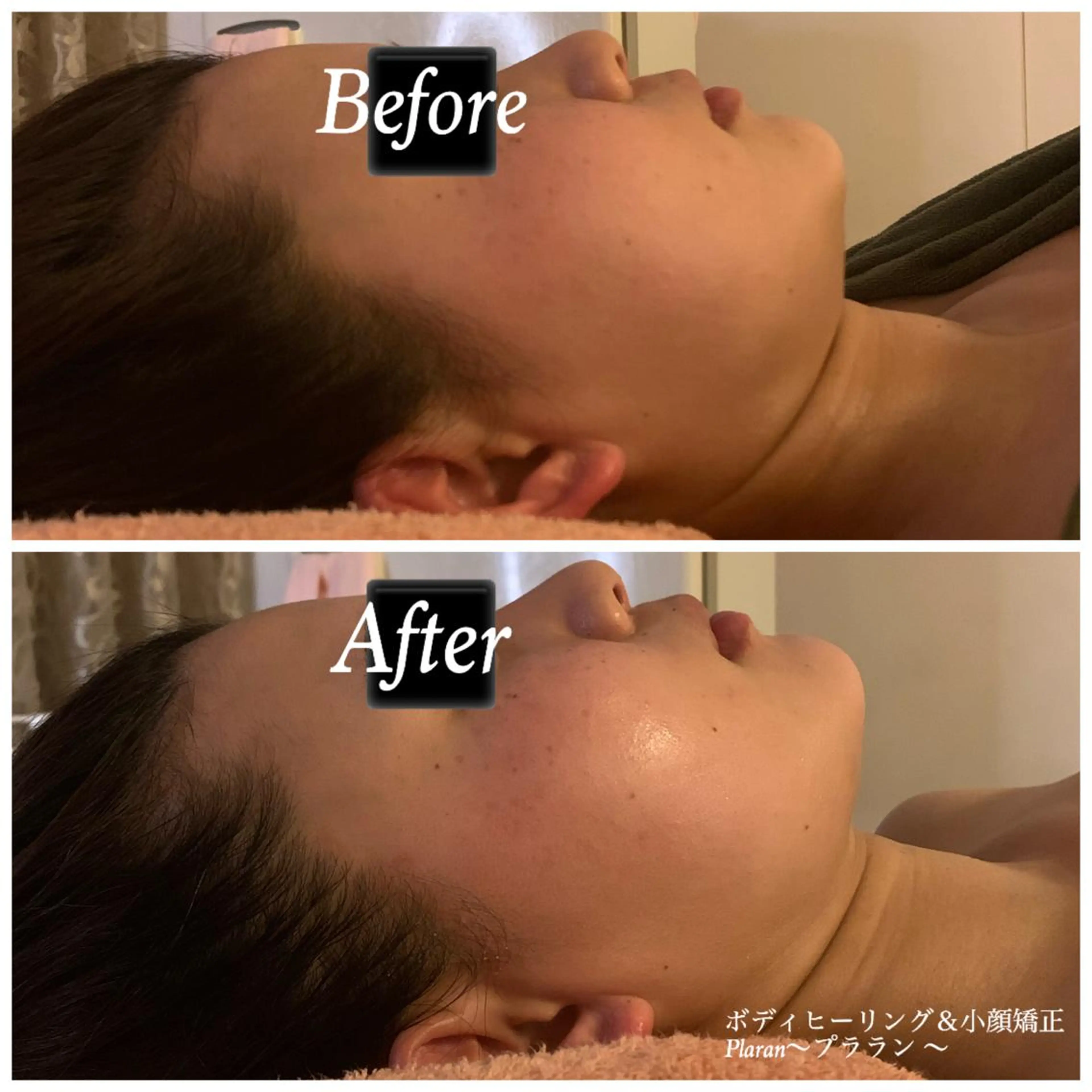 Plaran 〜プララン 〜のその他イメージ