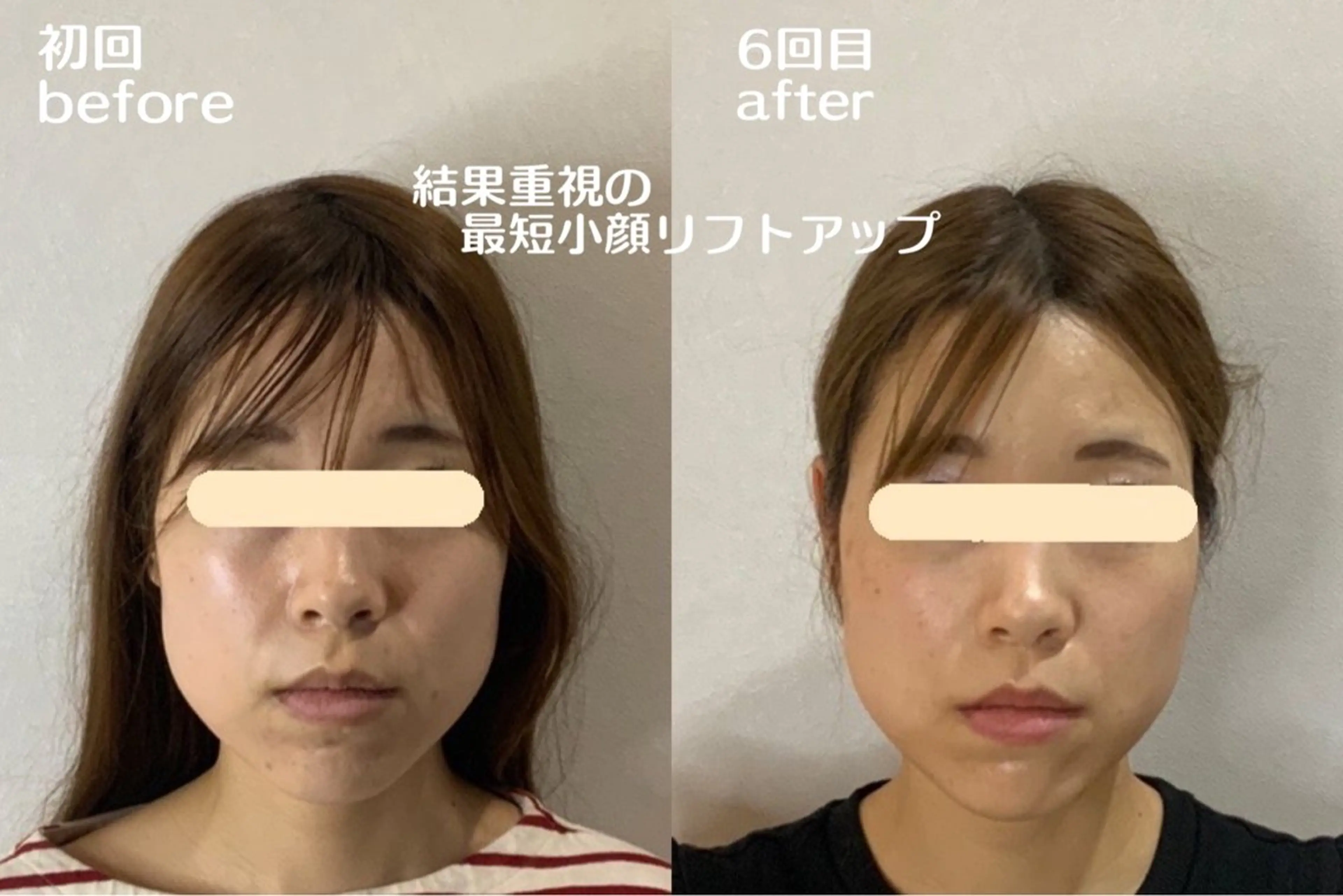 エステ 最速小顔・肌質管理 ❣️エスポワールのエステ・リラクイメージ