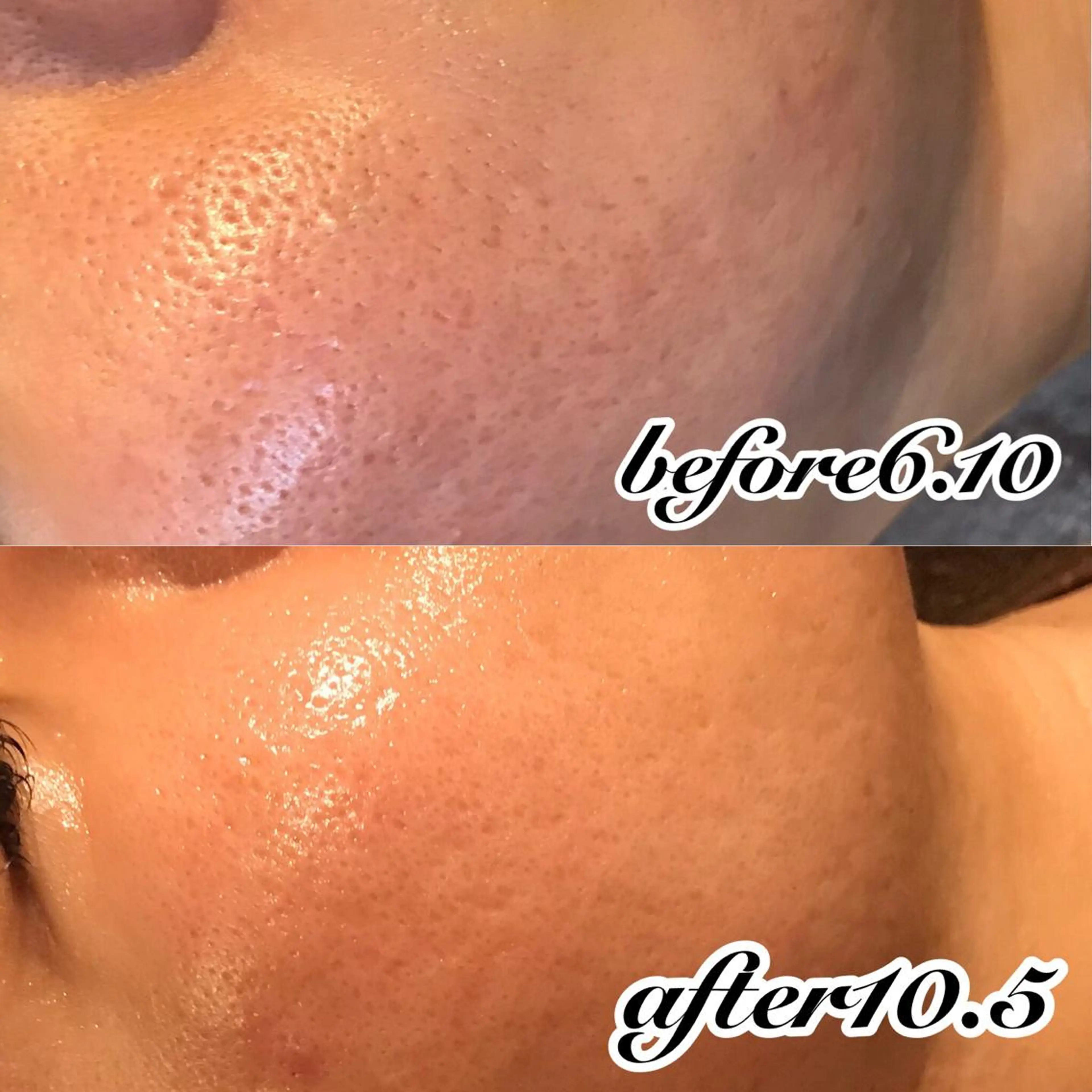 エステ 浜野 恵美のエステ・リラクイメージ