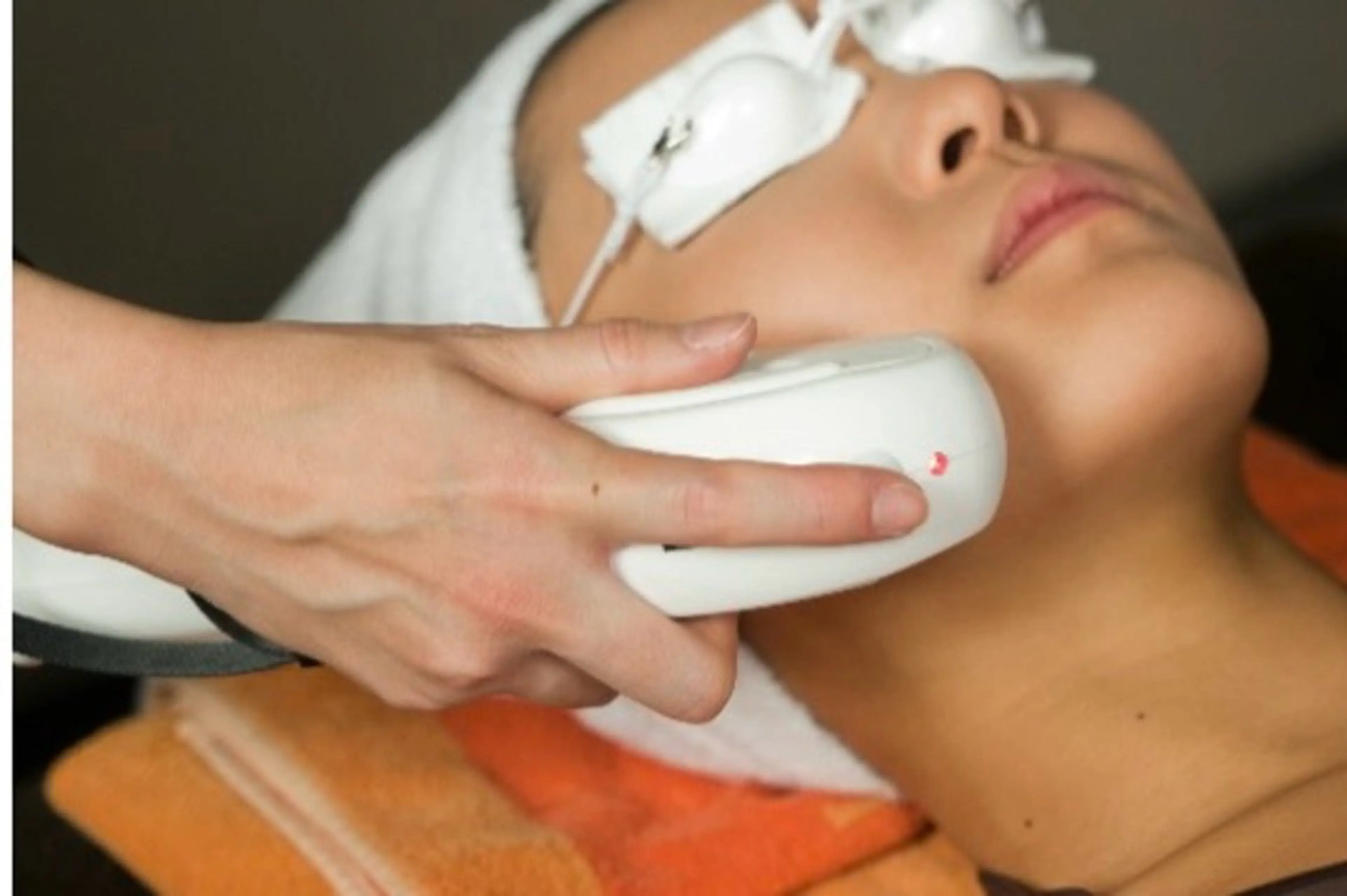 光フェイシャルの写真