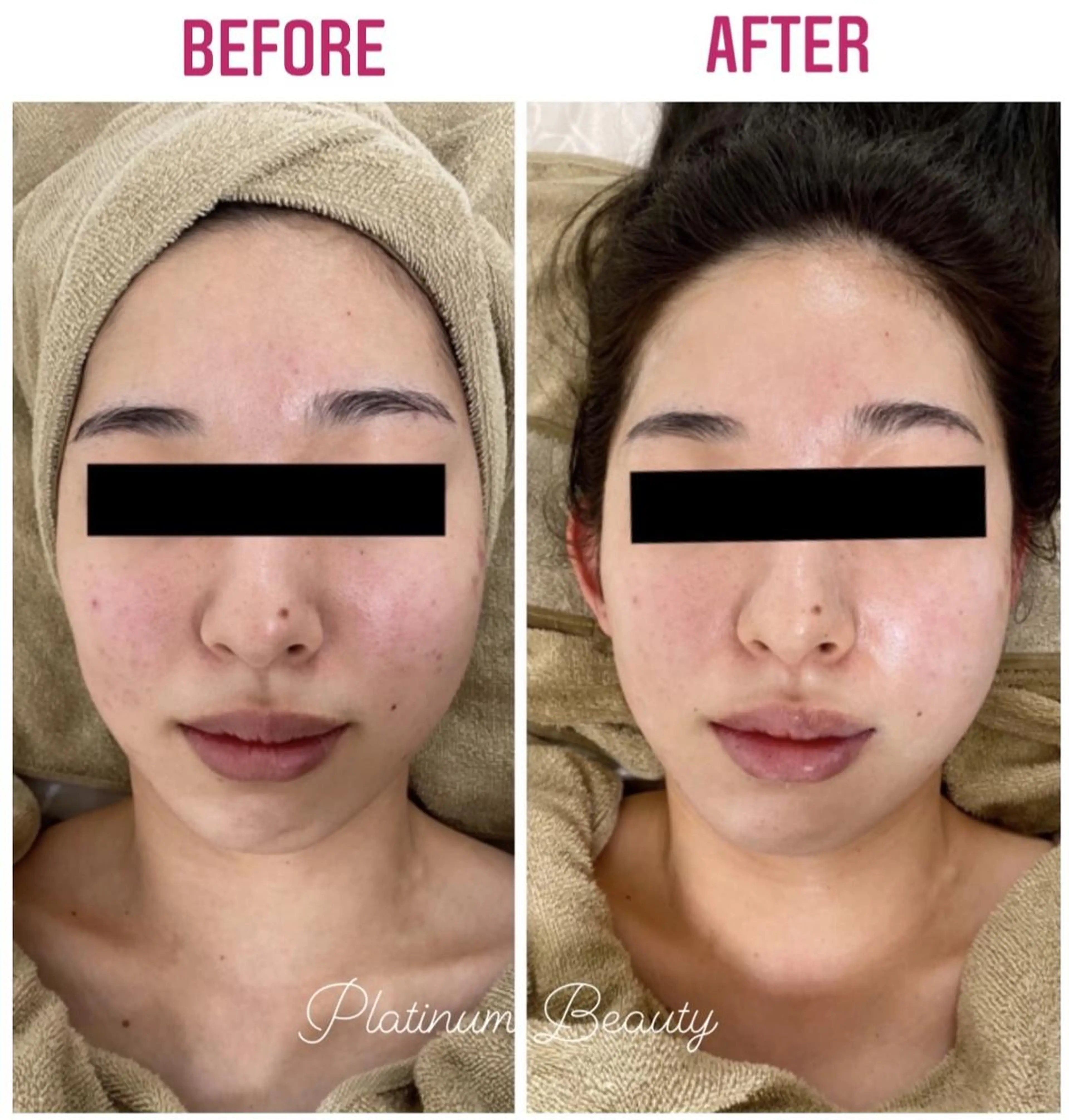 エステ プラティーヌ ボーテ【もものり】のその他イメージ