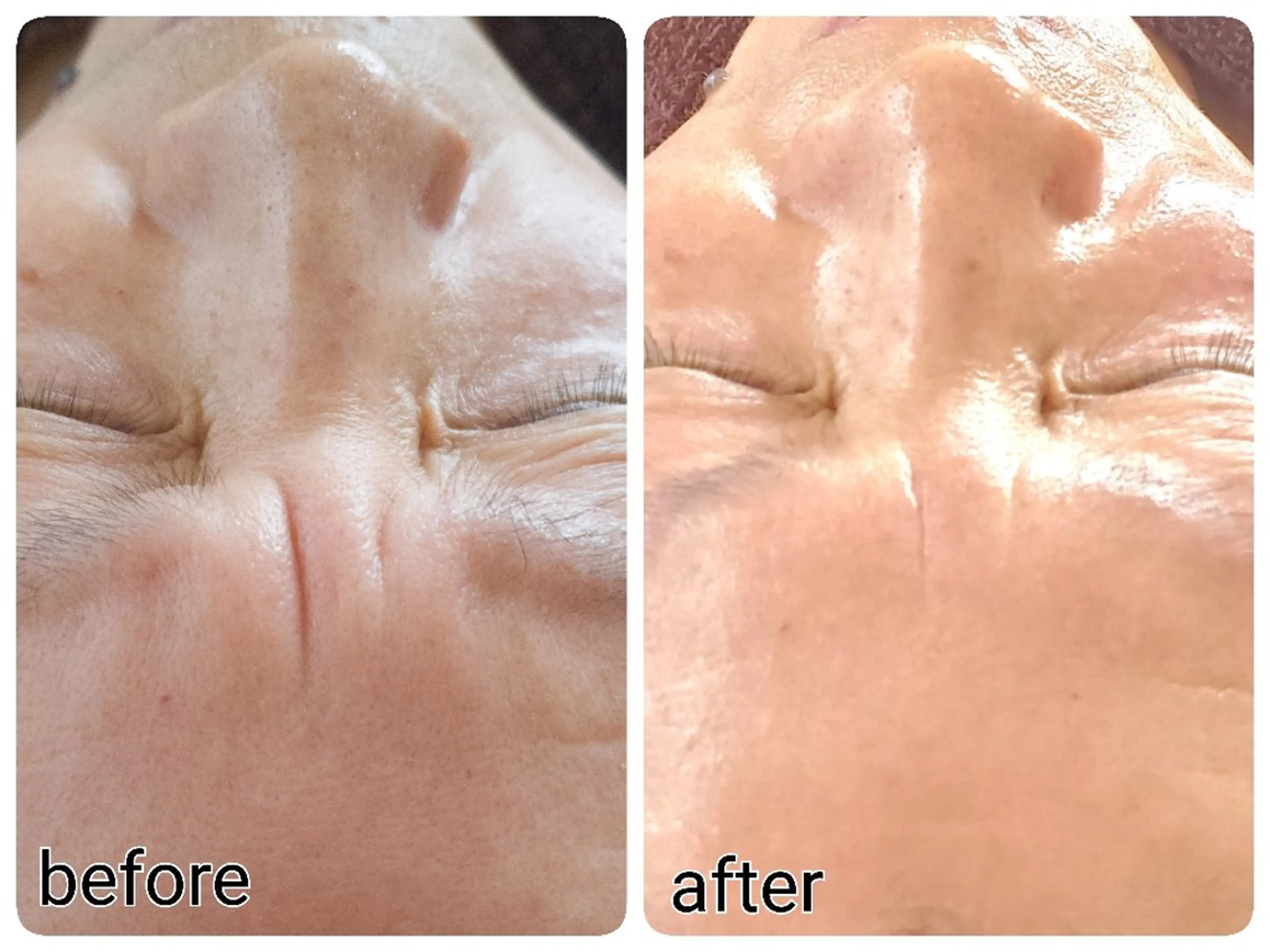 エステ 20代からのツヤ肌 サロン　シャルマンのエステ・リラクイメージ