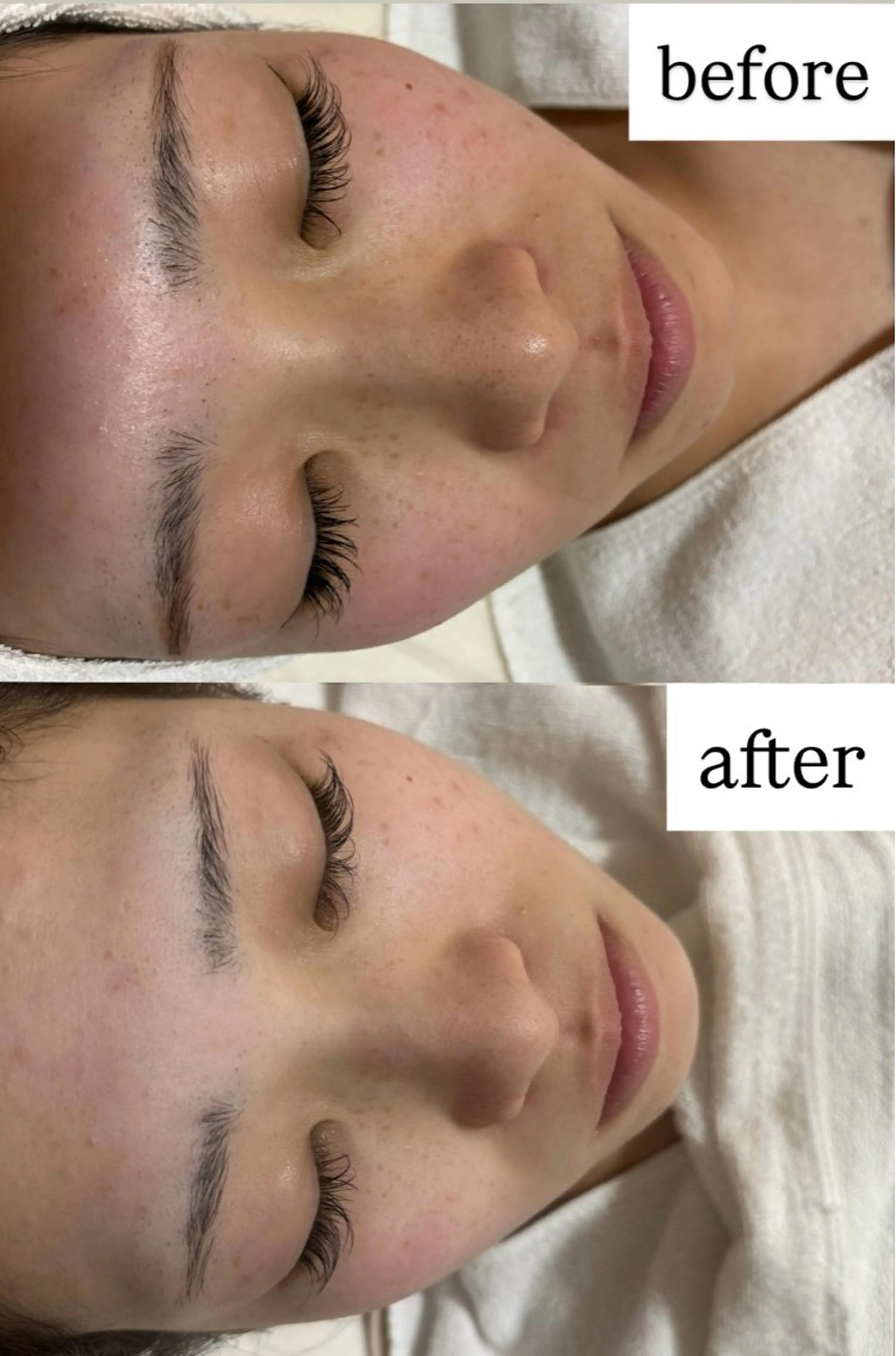 OTOHA / ありむらのエステ・リラクイメージ