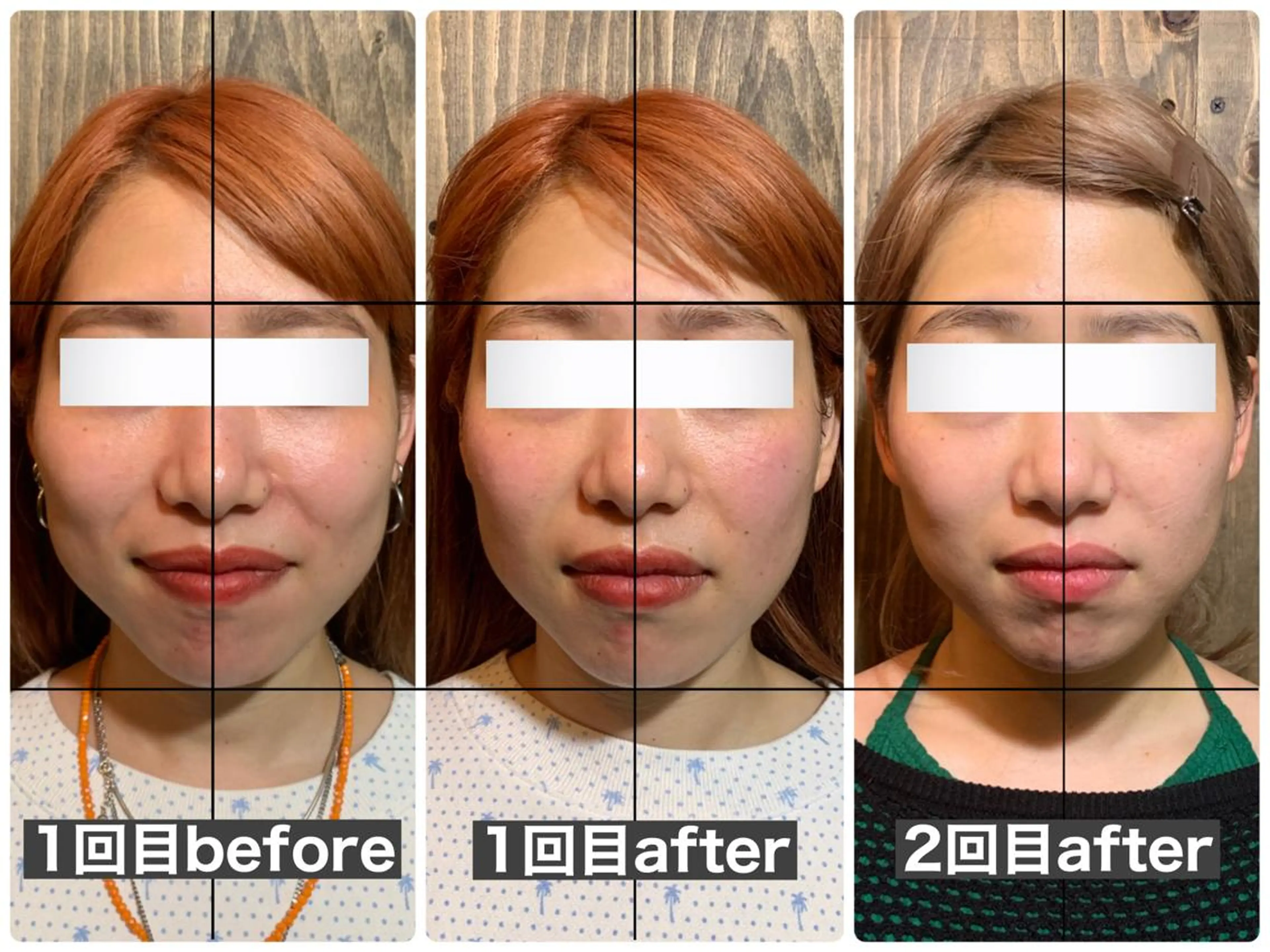 エステ リラク 💎後悔させない小顔 矯正💎イトヤマ🌱のエステ・リラクイメージ