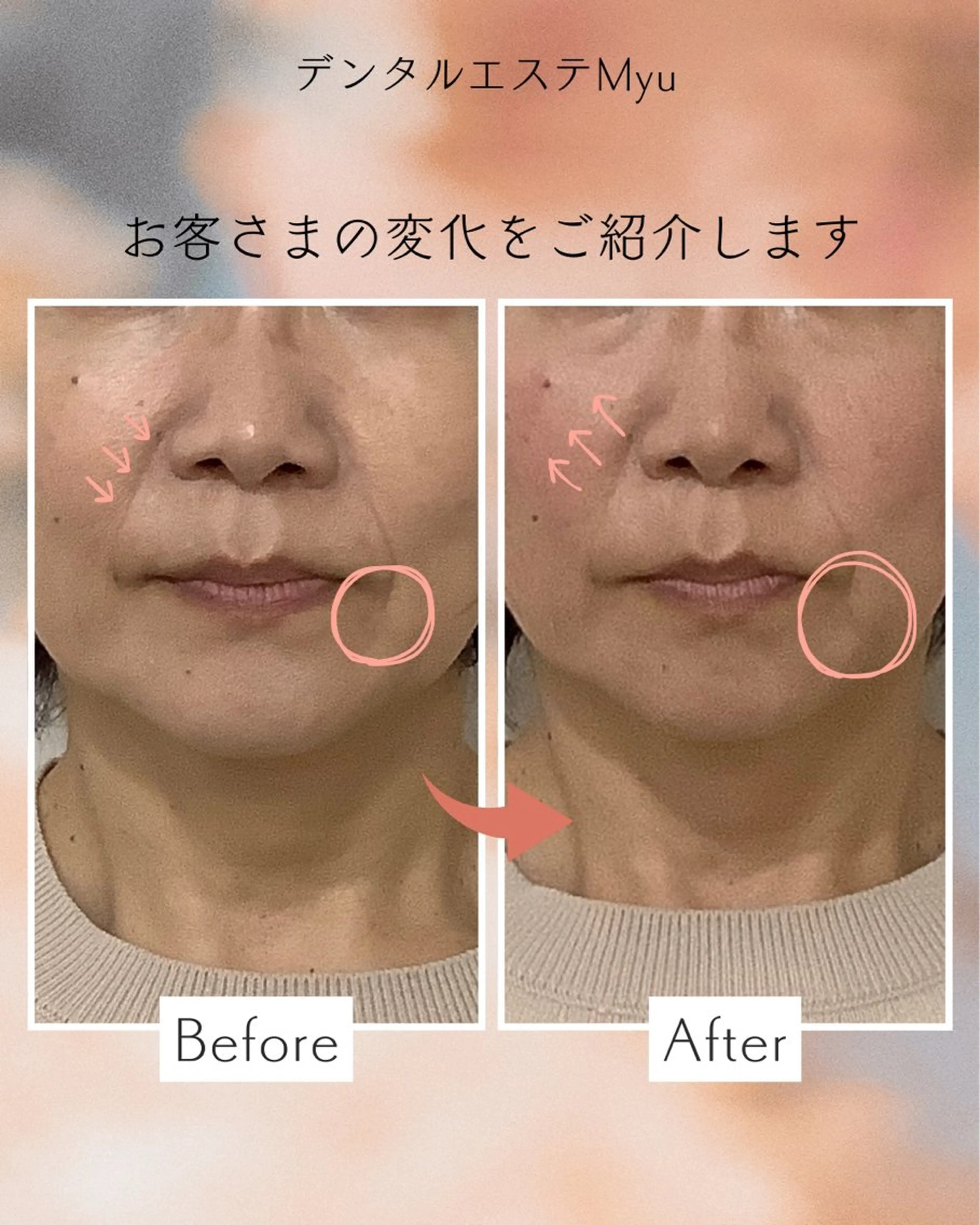 エステ Myu所属・Suzuki Yumiのエステ・リラクイメージ