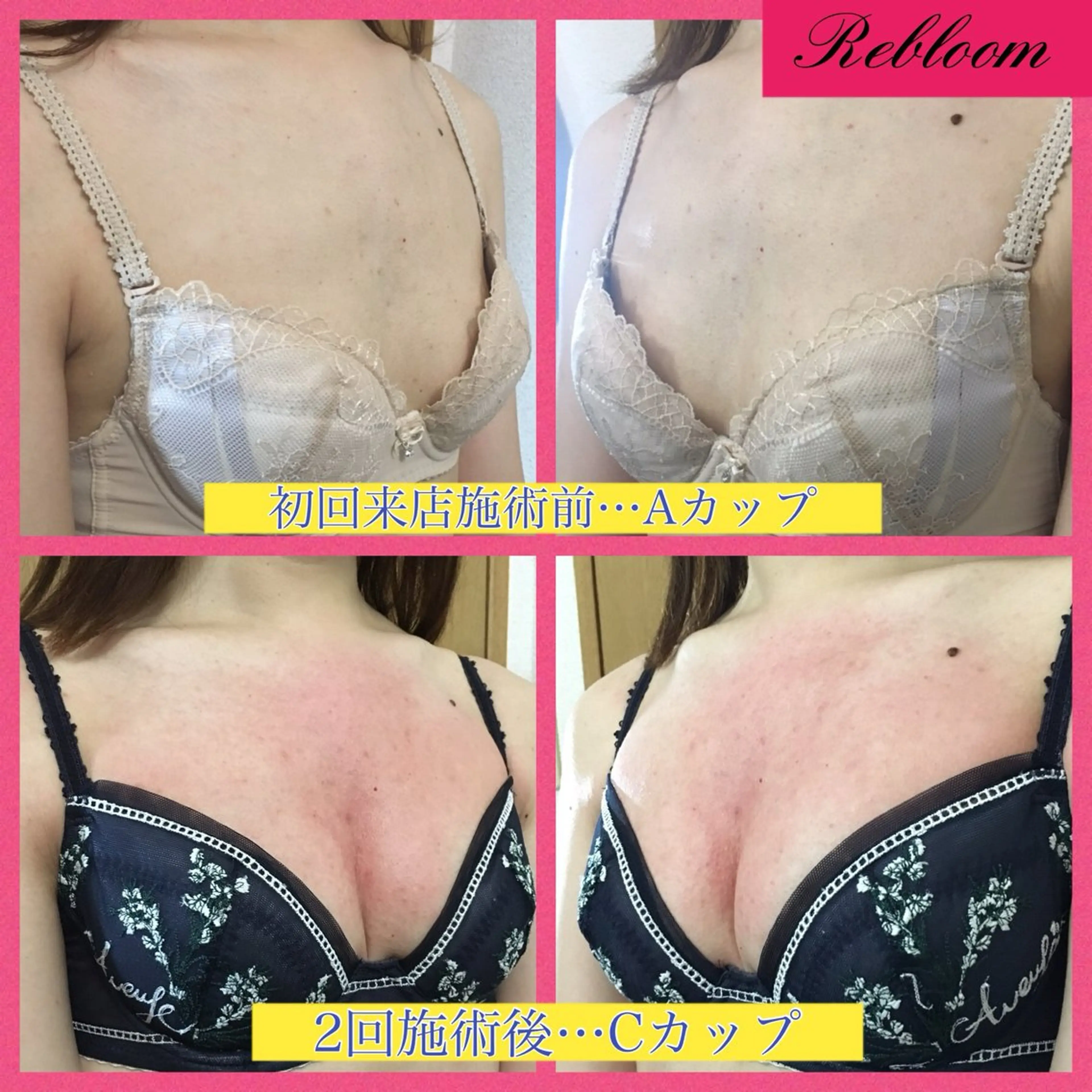 エステ デリケートな悩み解決 Rebloomのエステ・リラクイメージ