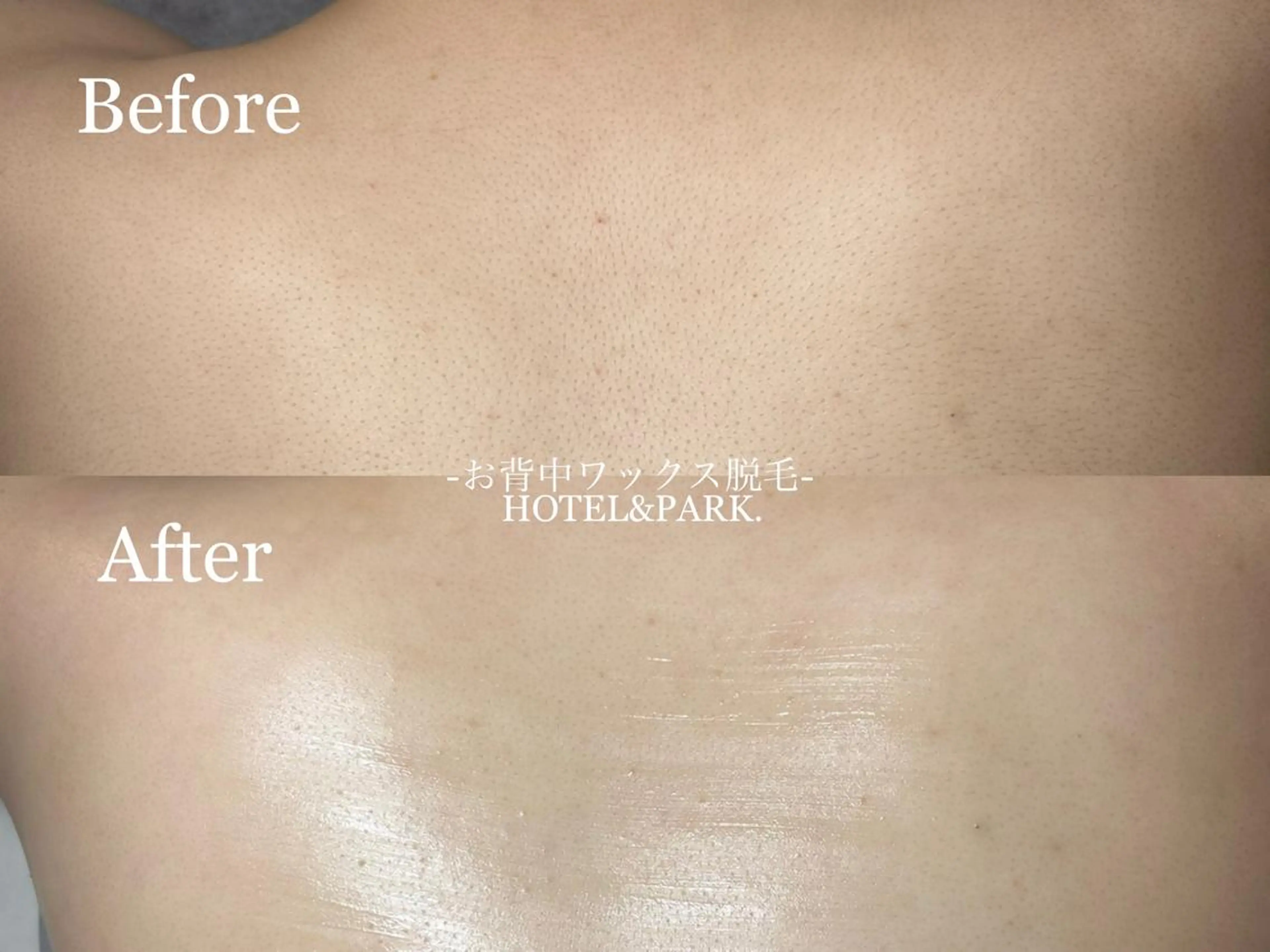 HOTEL&PARK . ワックス脱毛のエステ・リラクイメージ