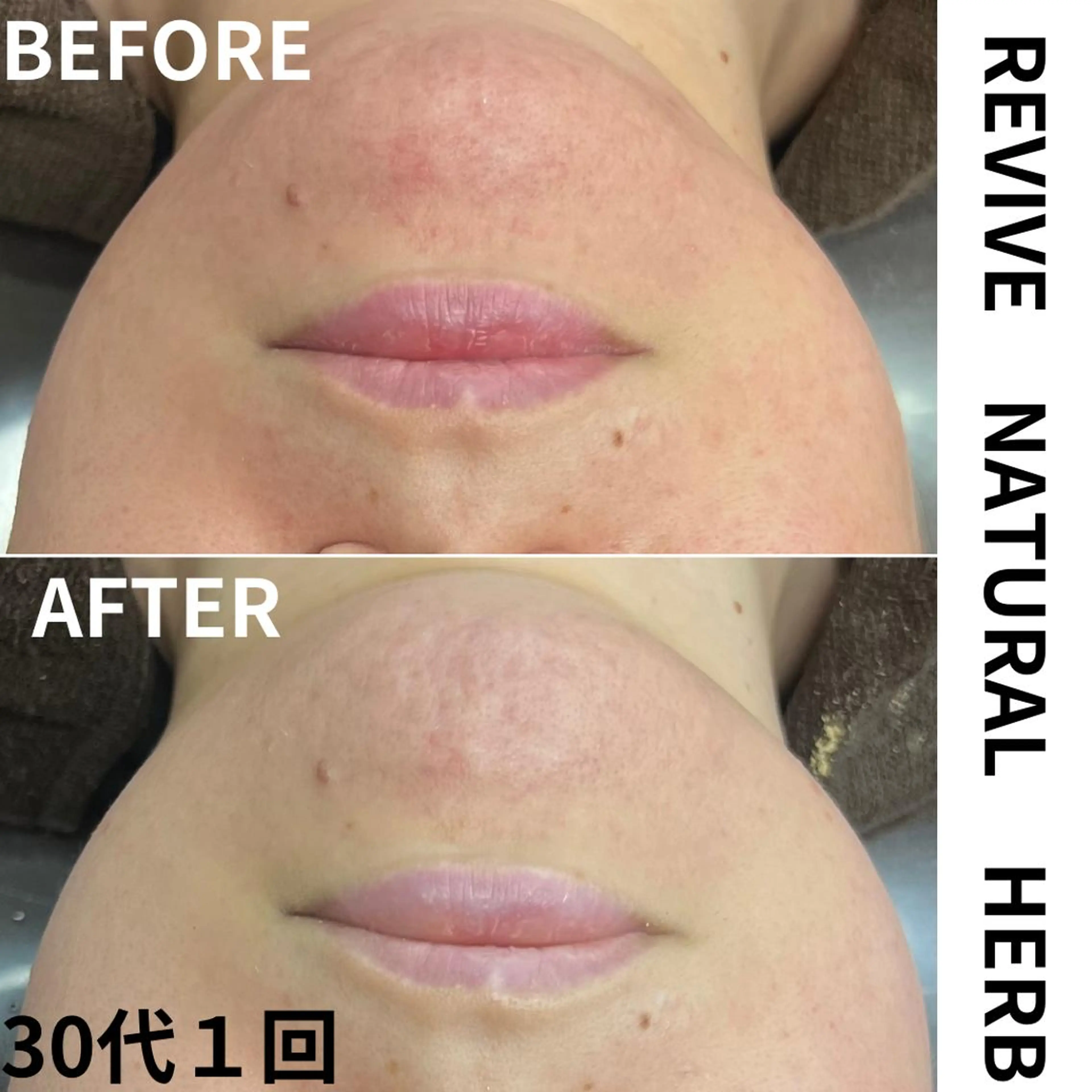 エステ リラク プレイス天王寺店 【肌質改善/ハーブ】のエステ・リラクイメージ